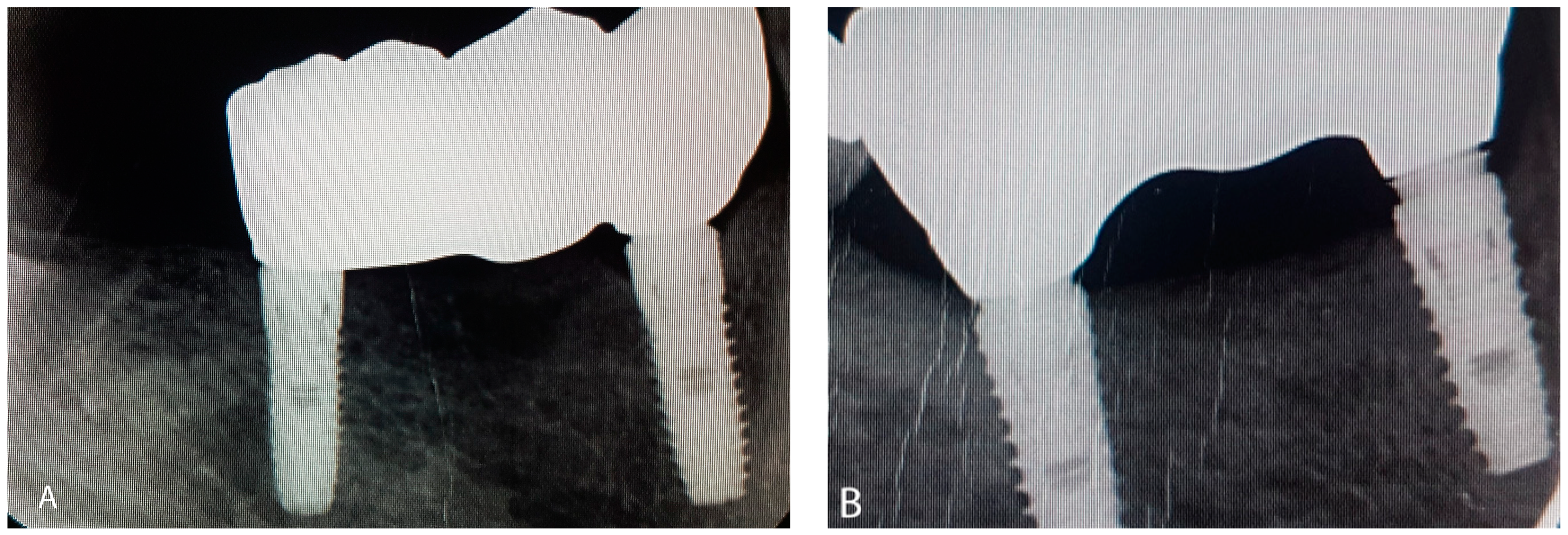 Ijerph 19 11456 g002 Ijerph 19 11456 g002