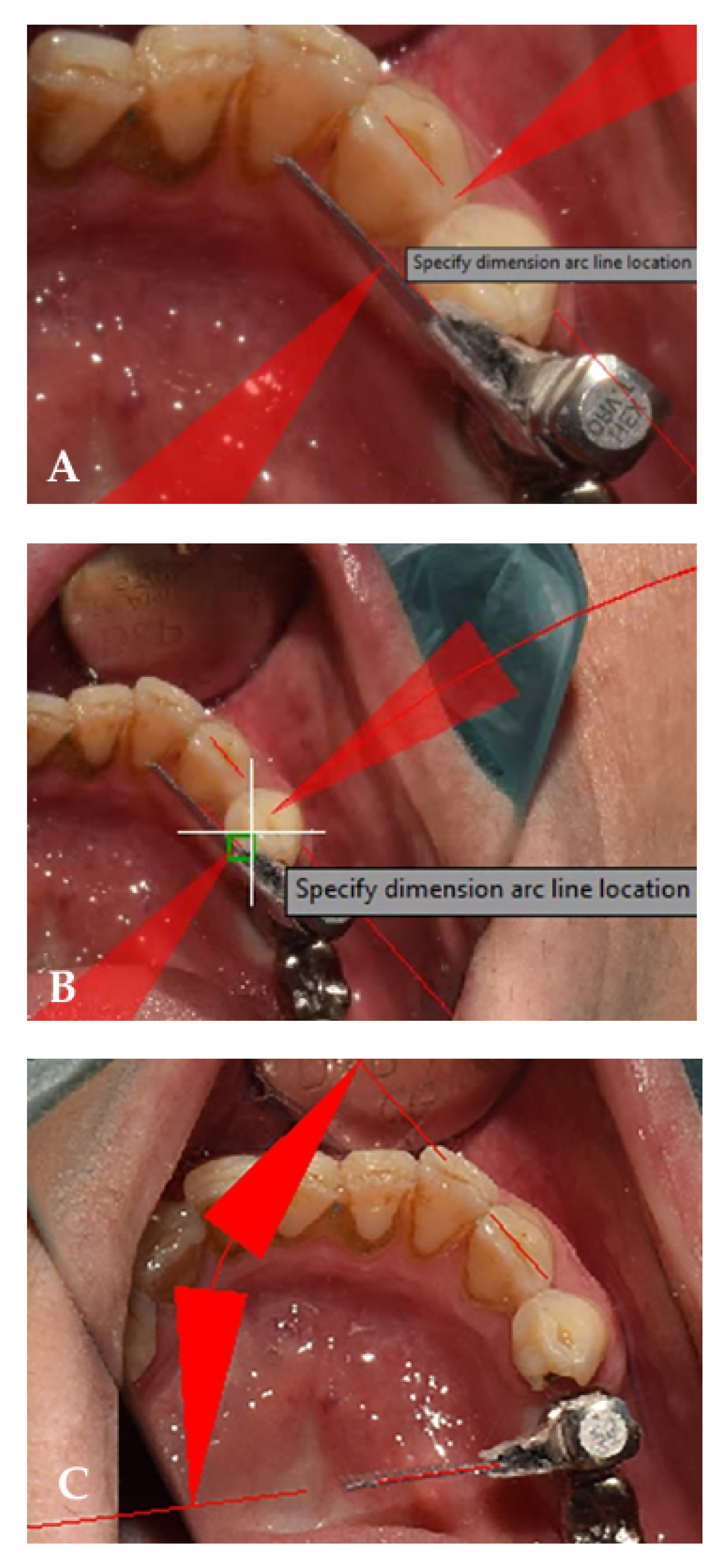 Ijerph 19 11456 g003 Ijerph 19 11456 g003
