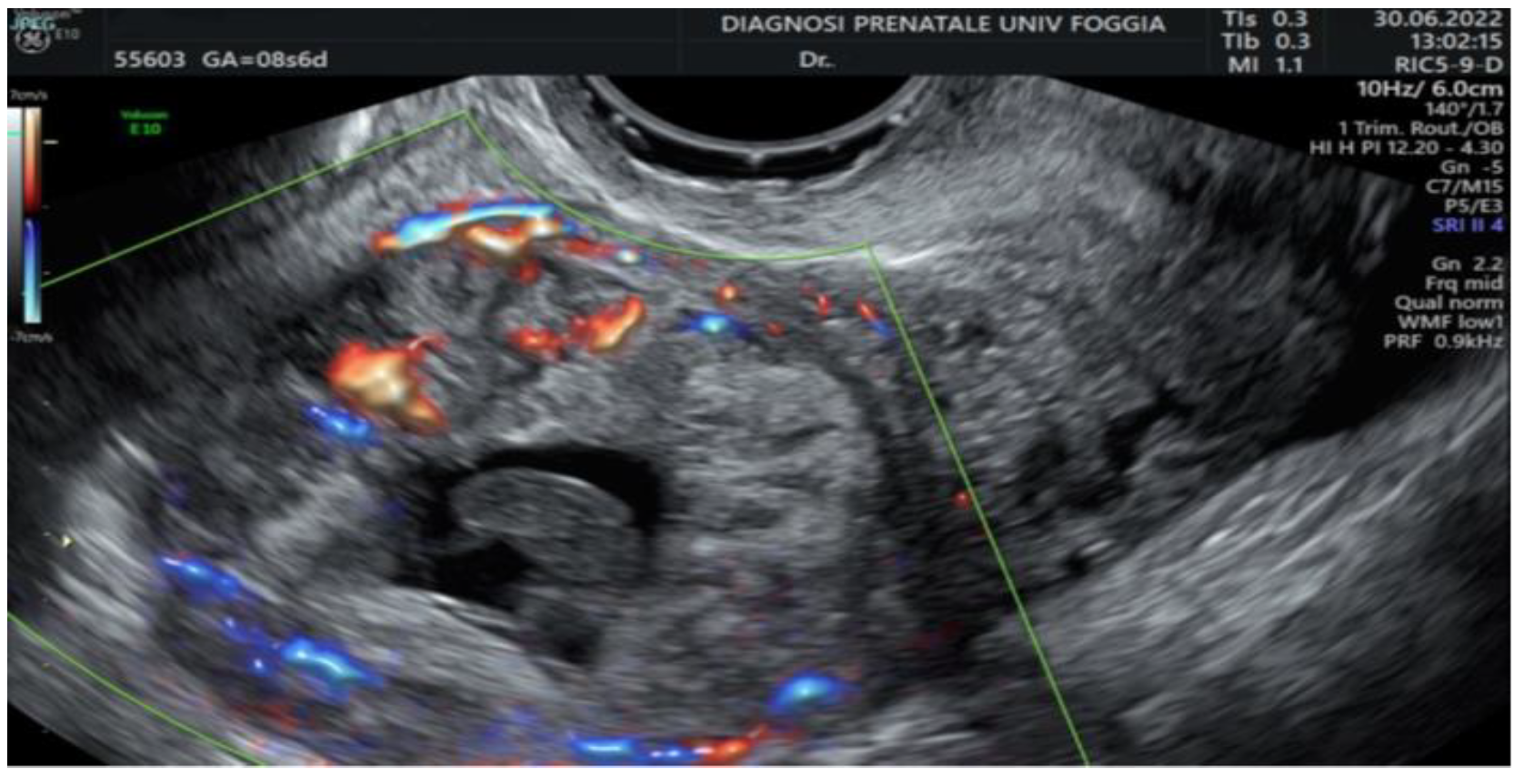 Ijerph 19 11464 g005 550