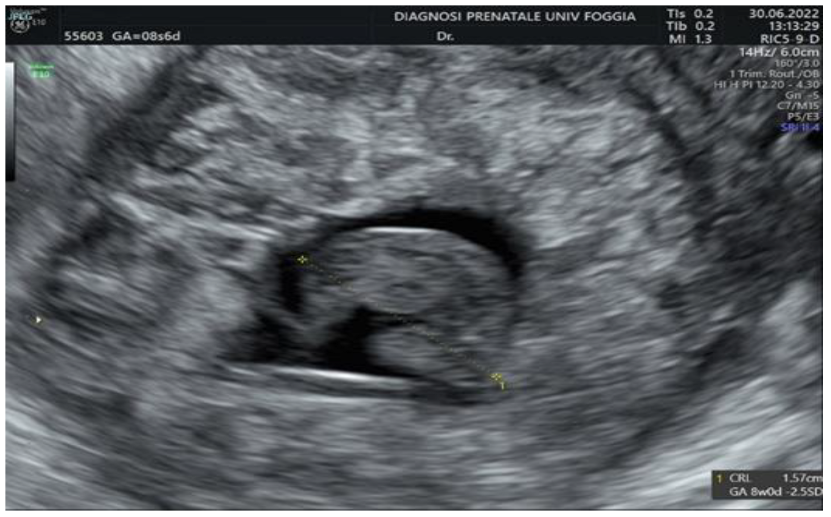 Ijerph 19 11464 g006 550