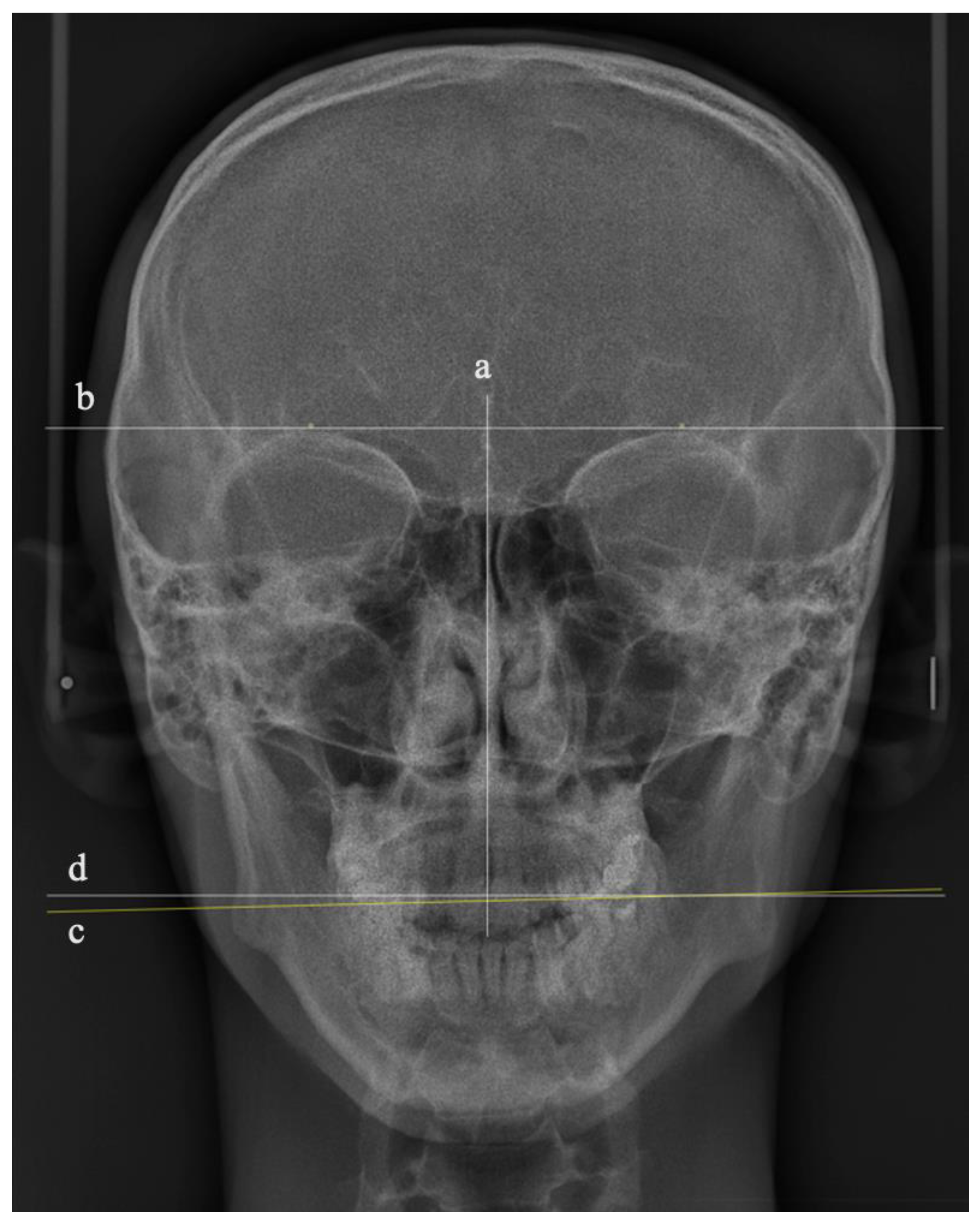 Ijerph 19 11623 g002 550