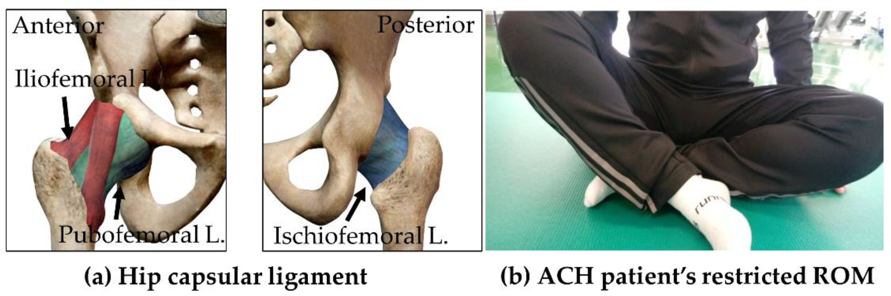 56 Measurement of the Gluteal (hip)® girth showing a side and front view