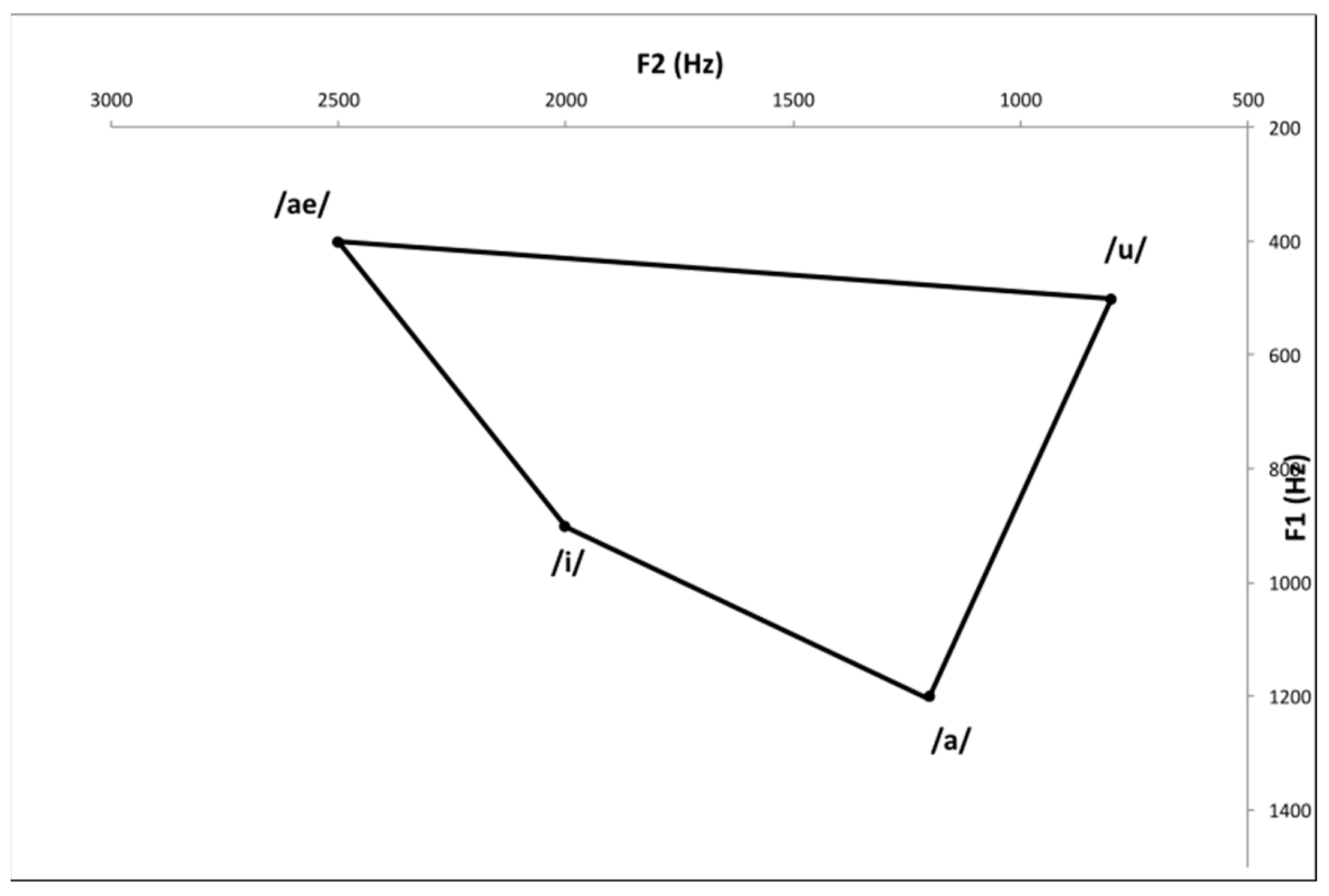 Destruction of Vowel Space Area in Patients with Dysphagia
