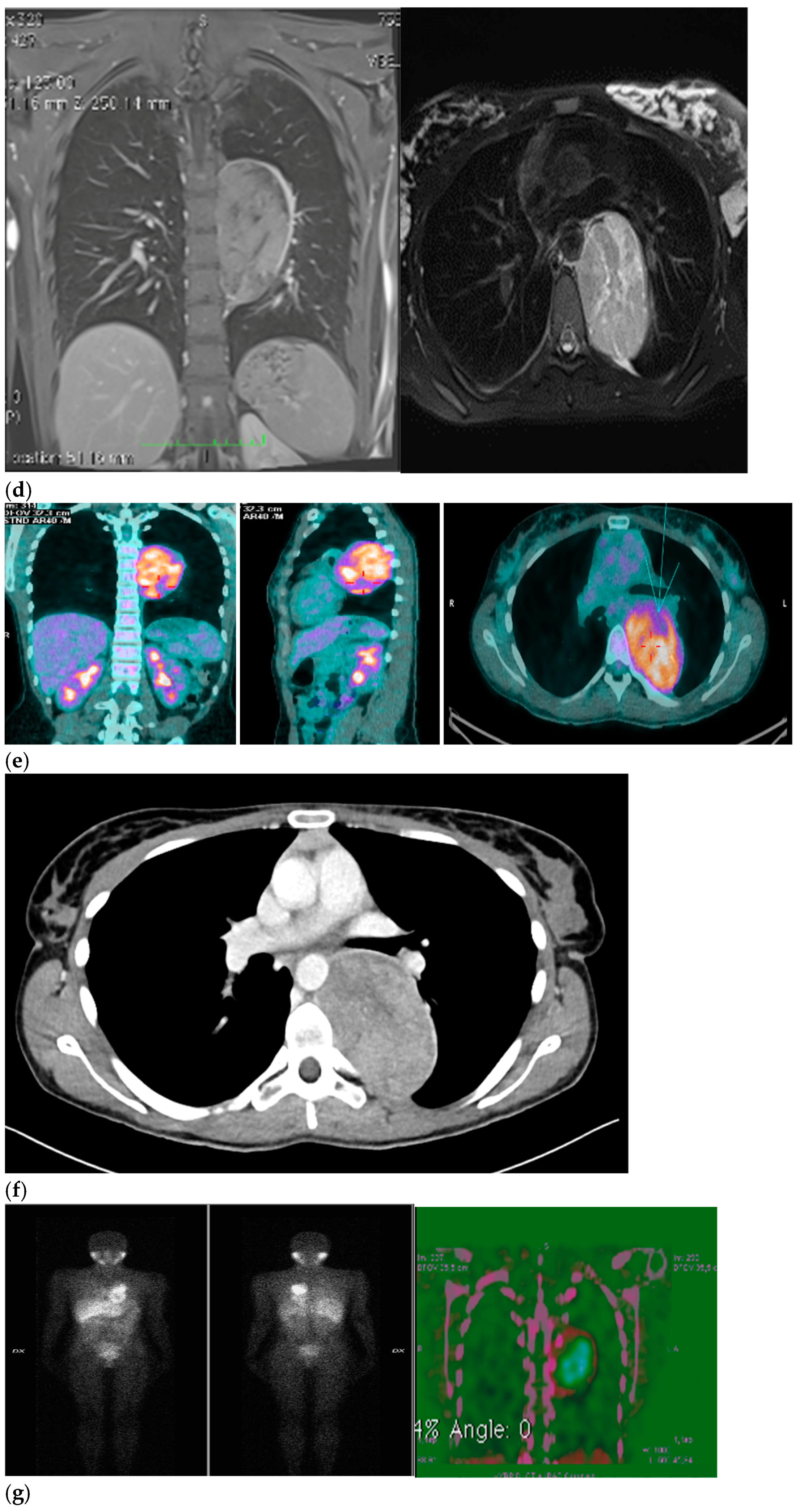 Ijerph 19 13448 g001b