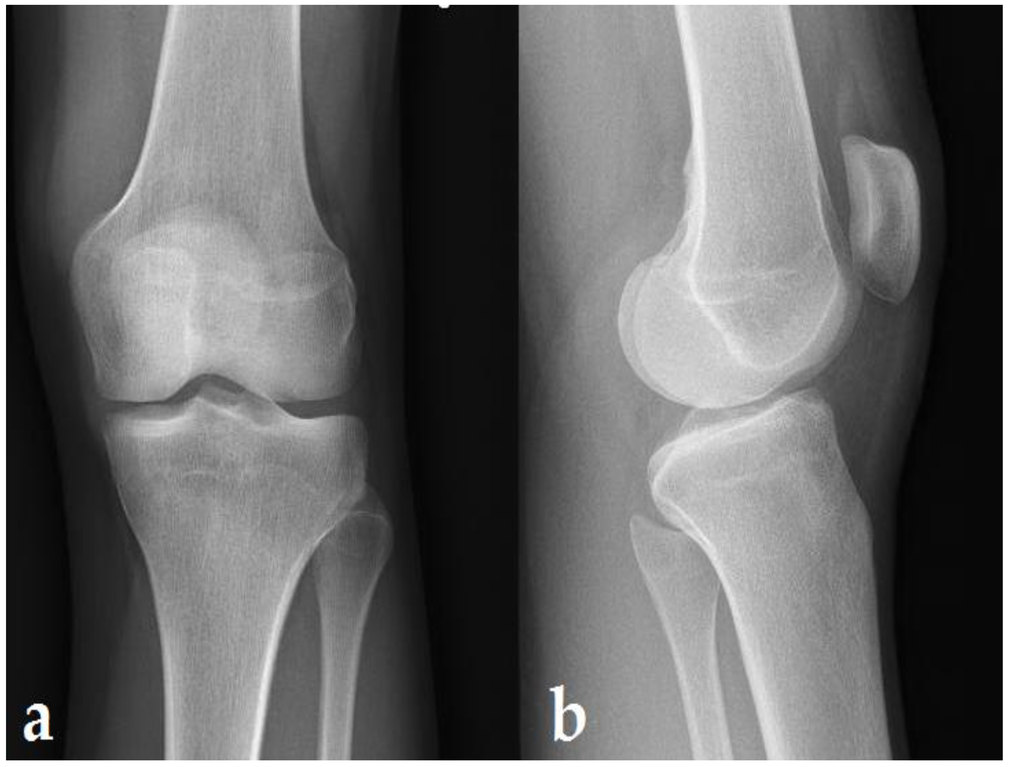 Ijerph 19 14202 g003 Ijerph 19 14202 g003