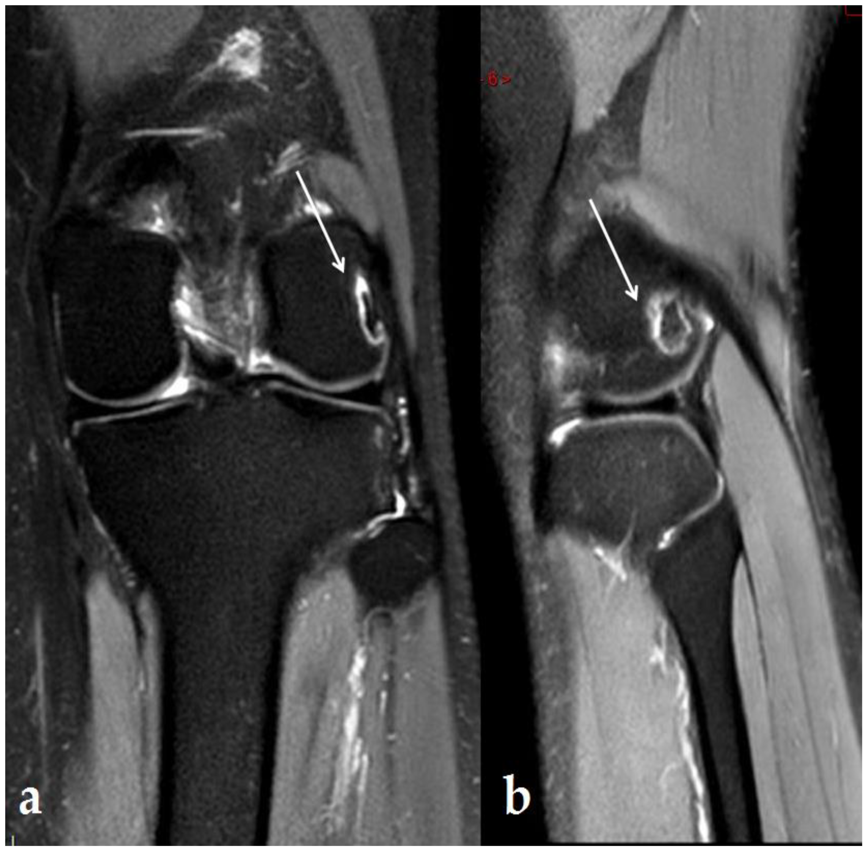 Ijerph 19 14202 g005 Ijerph 19 14202 g005