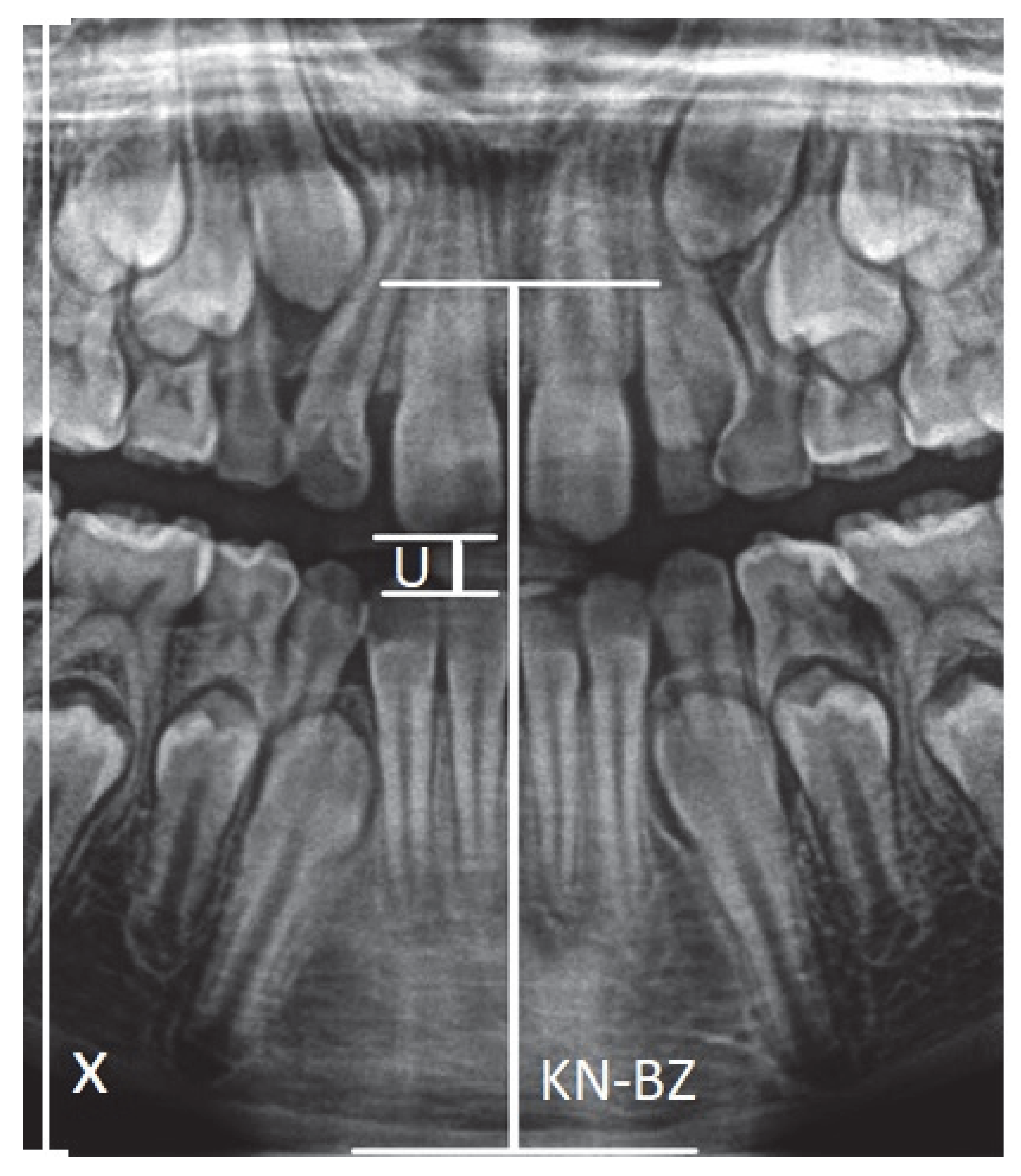 Ijerph 19 15240 g001 Ijerph 19 15240 g001