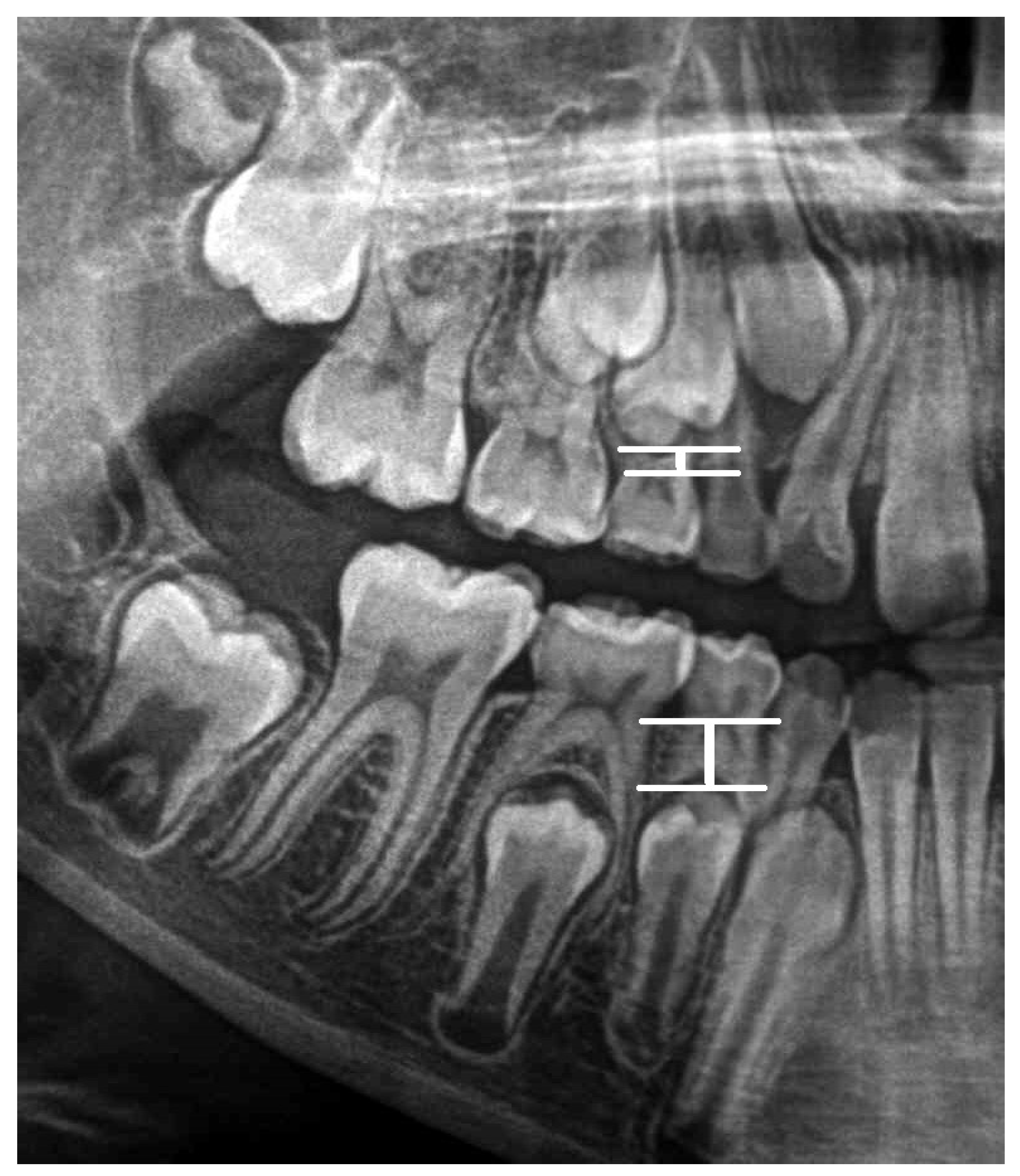 Ijerph 19 15240 g005 Ijerph 19 15240 g005
