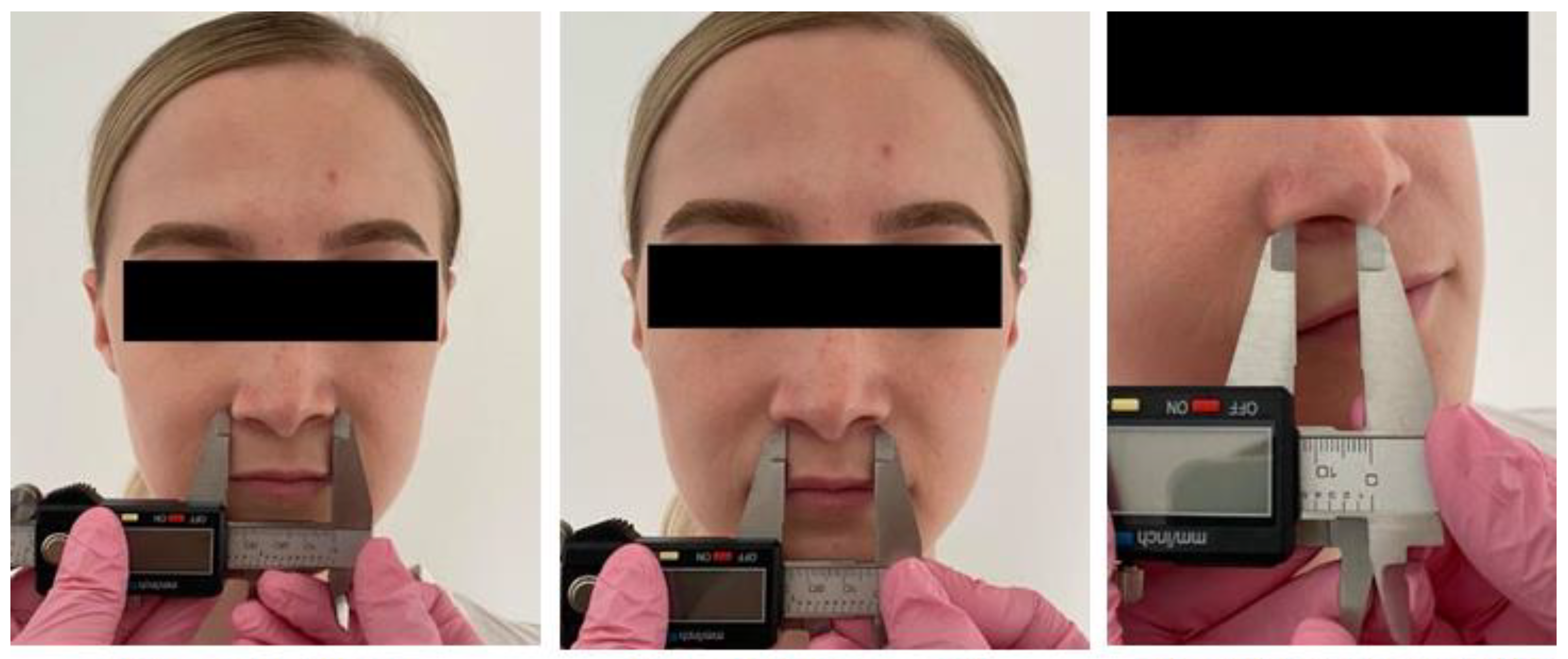 Ijerph 19 16028 g003