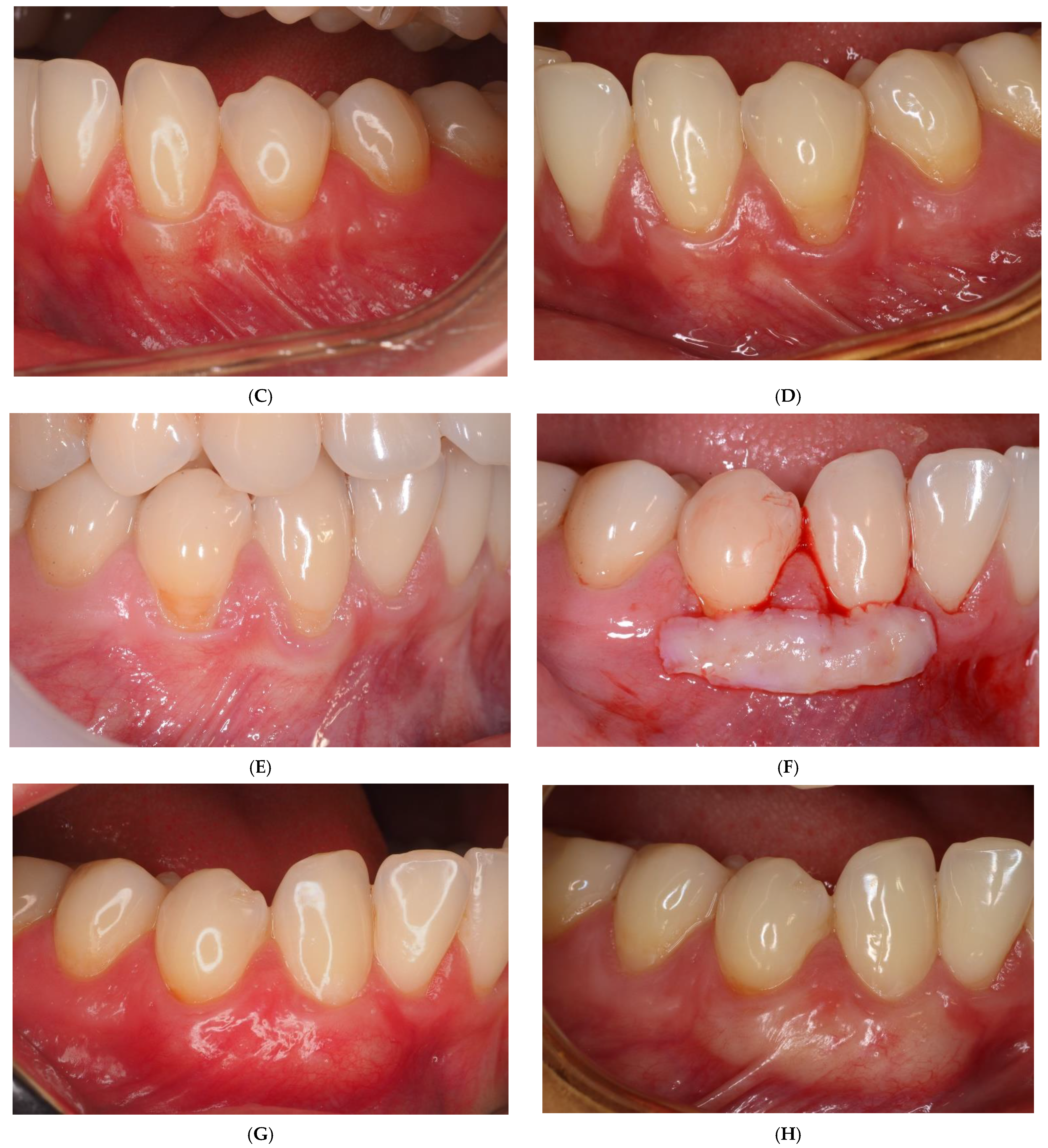 Ijerph 19 16444 g002b