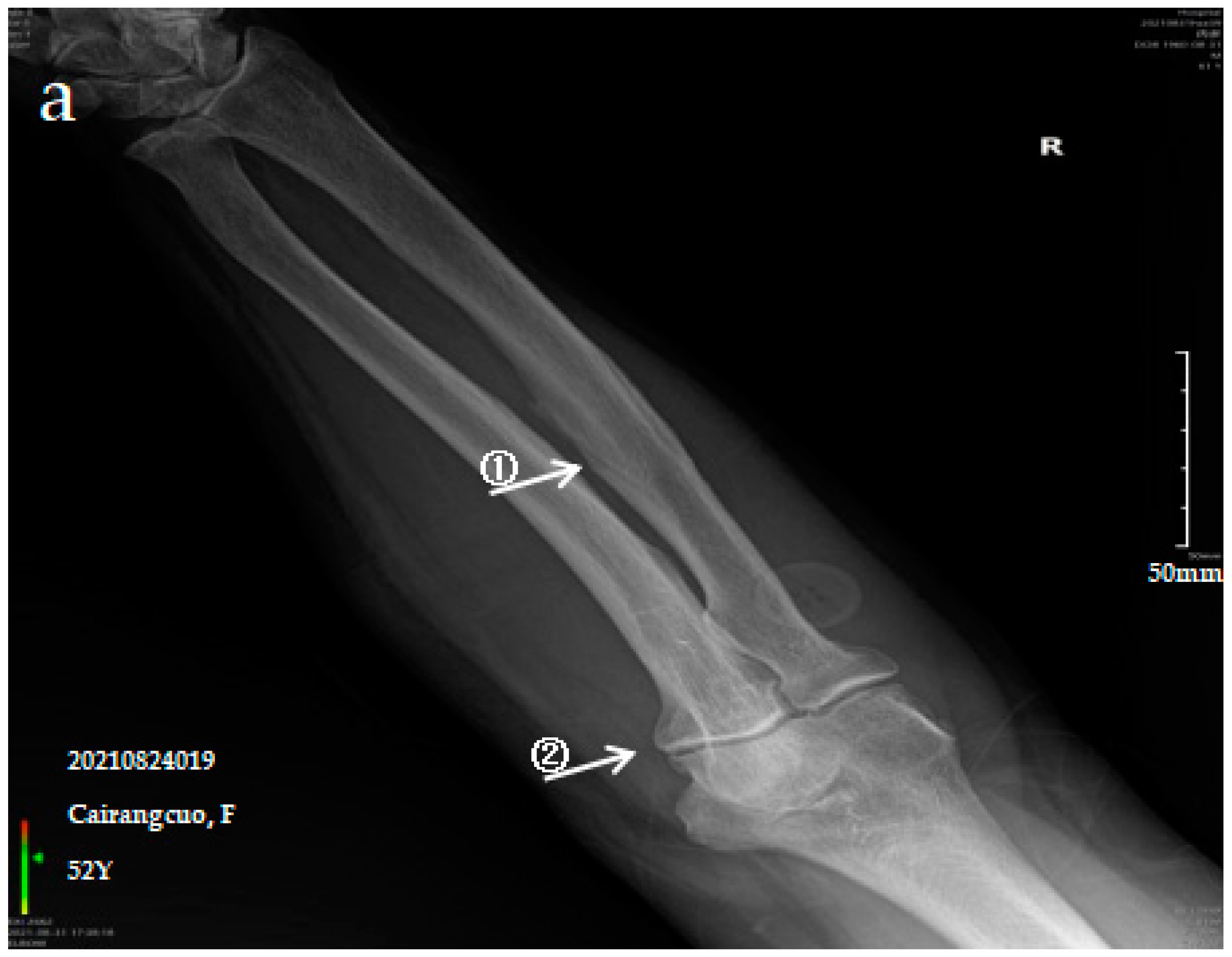 Ijerph 19 16555 g001a Ijerph 19 16555 g001a