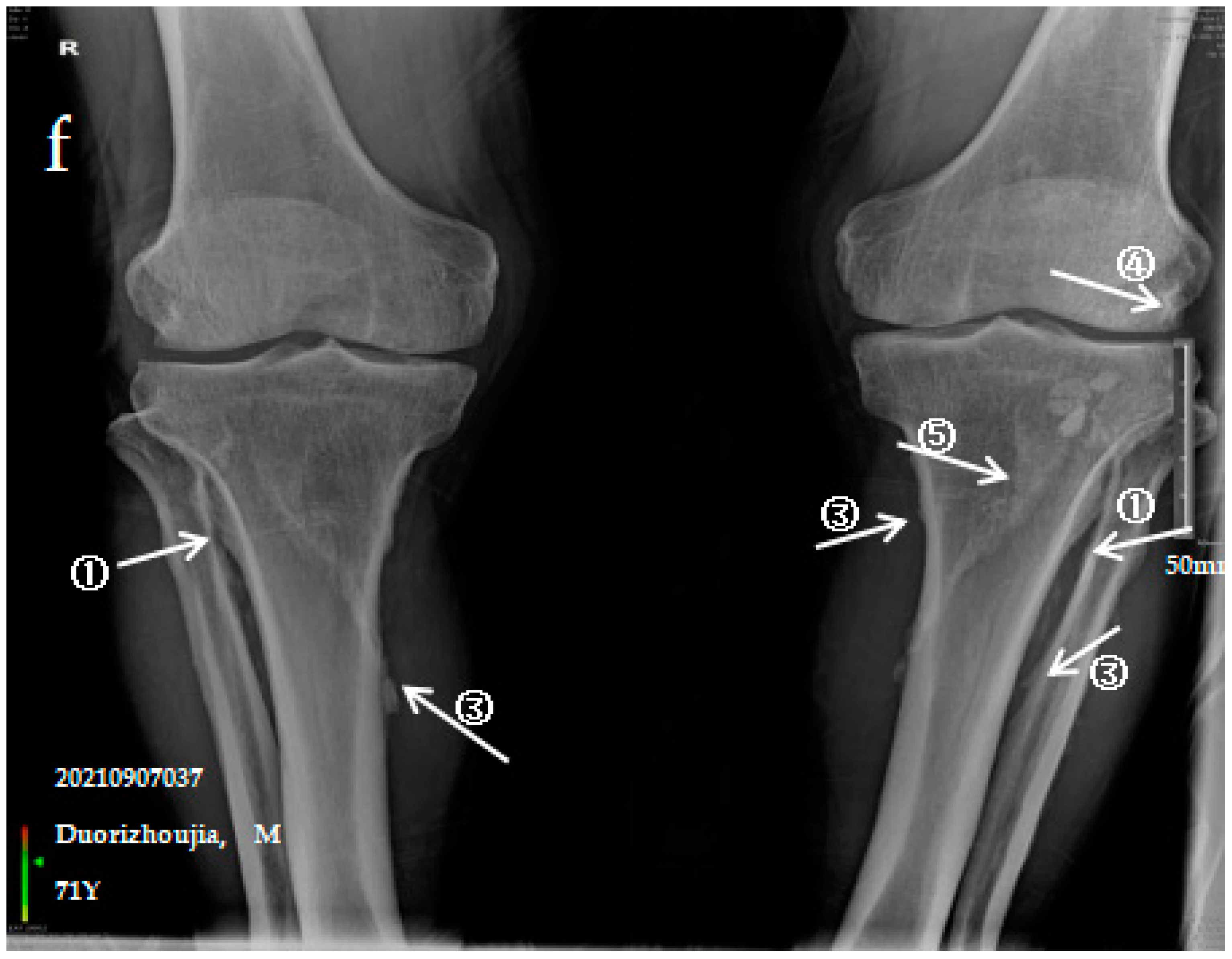 Ijerph 19 16555 g001d Ijerph 19 16555 g001d