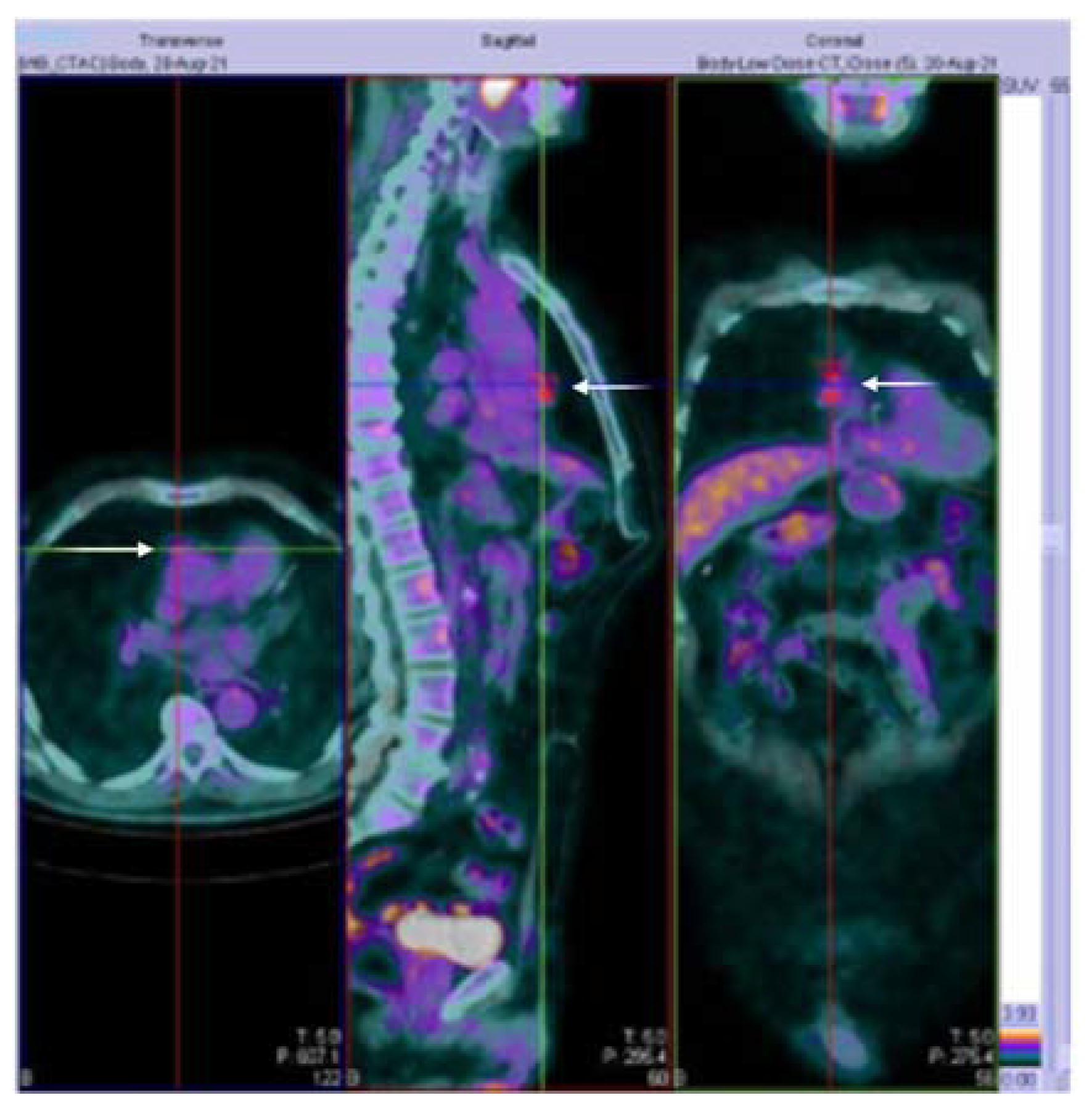 Ijerph 20 00467 g002