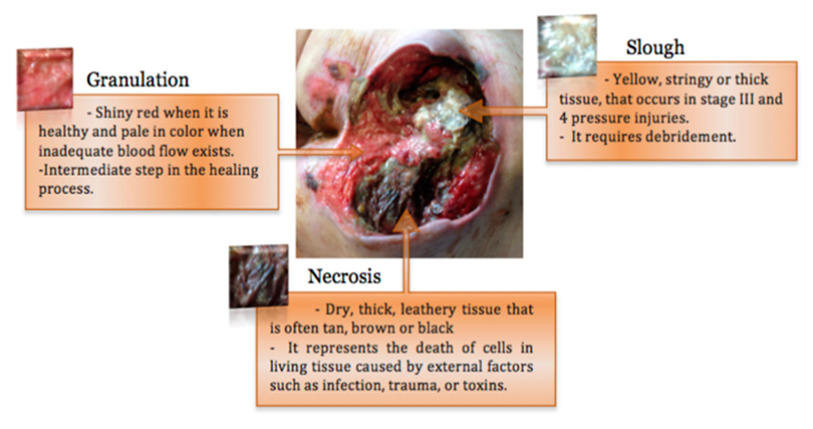 Ijerph 20 00796 g003 Ijerph 20 00796 g003
