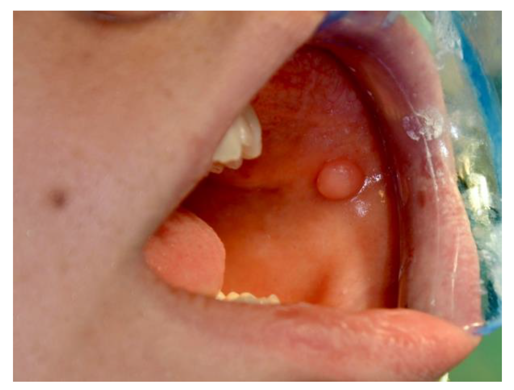 Ijerph 20 00835 g005