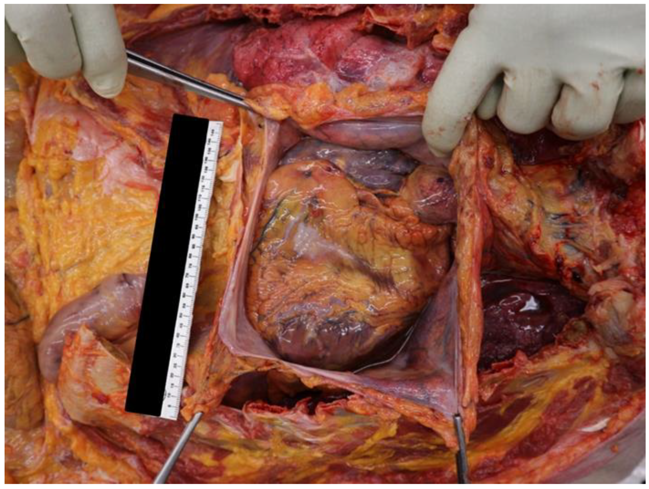 Ijerph 20 00884 g002 Ijerph 20 00884 g002