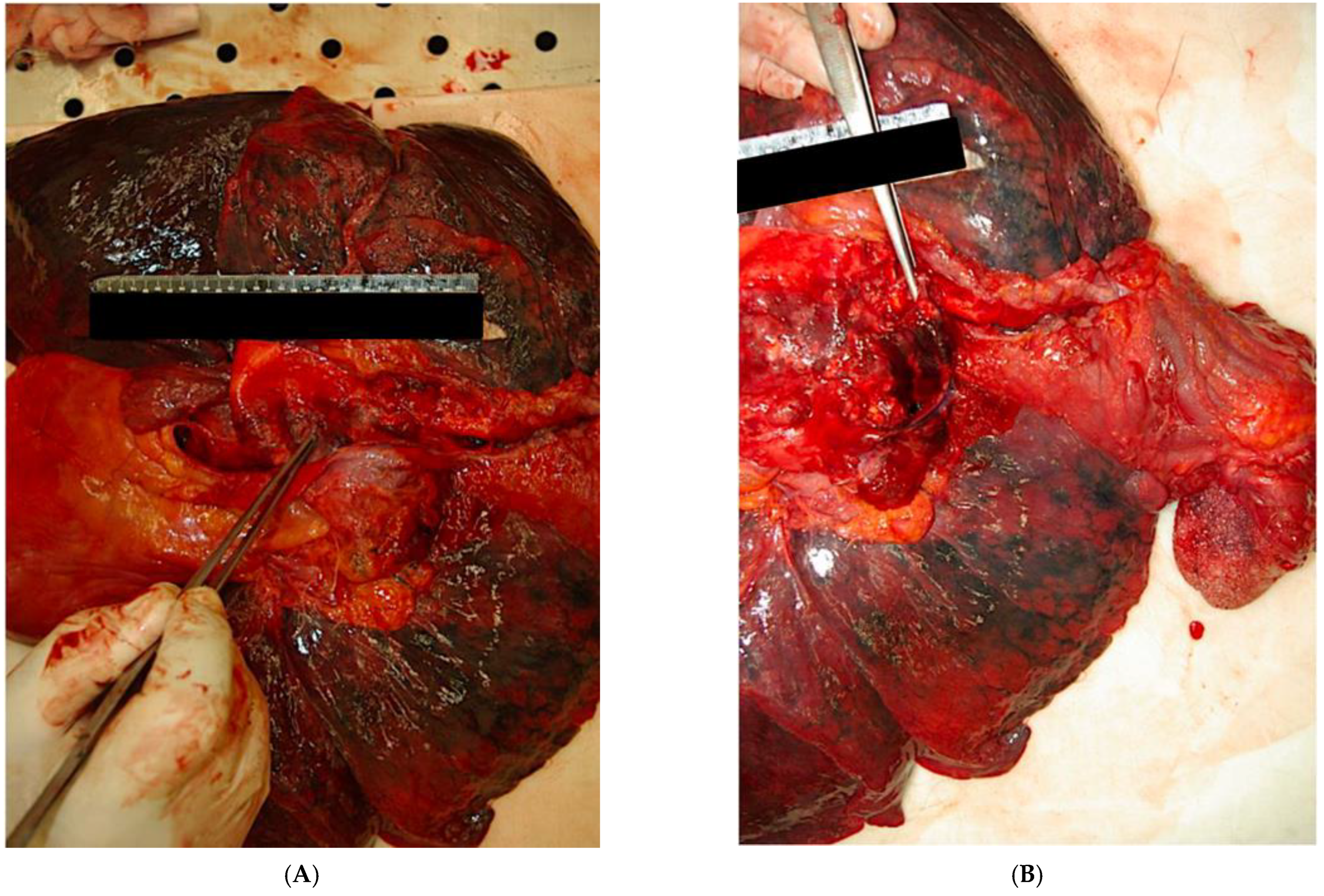 Ijerph 20 00884 g004 Ijerph 20 00884 g004
