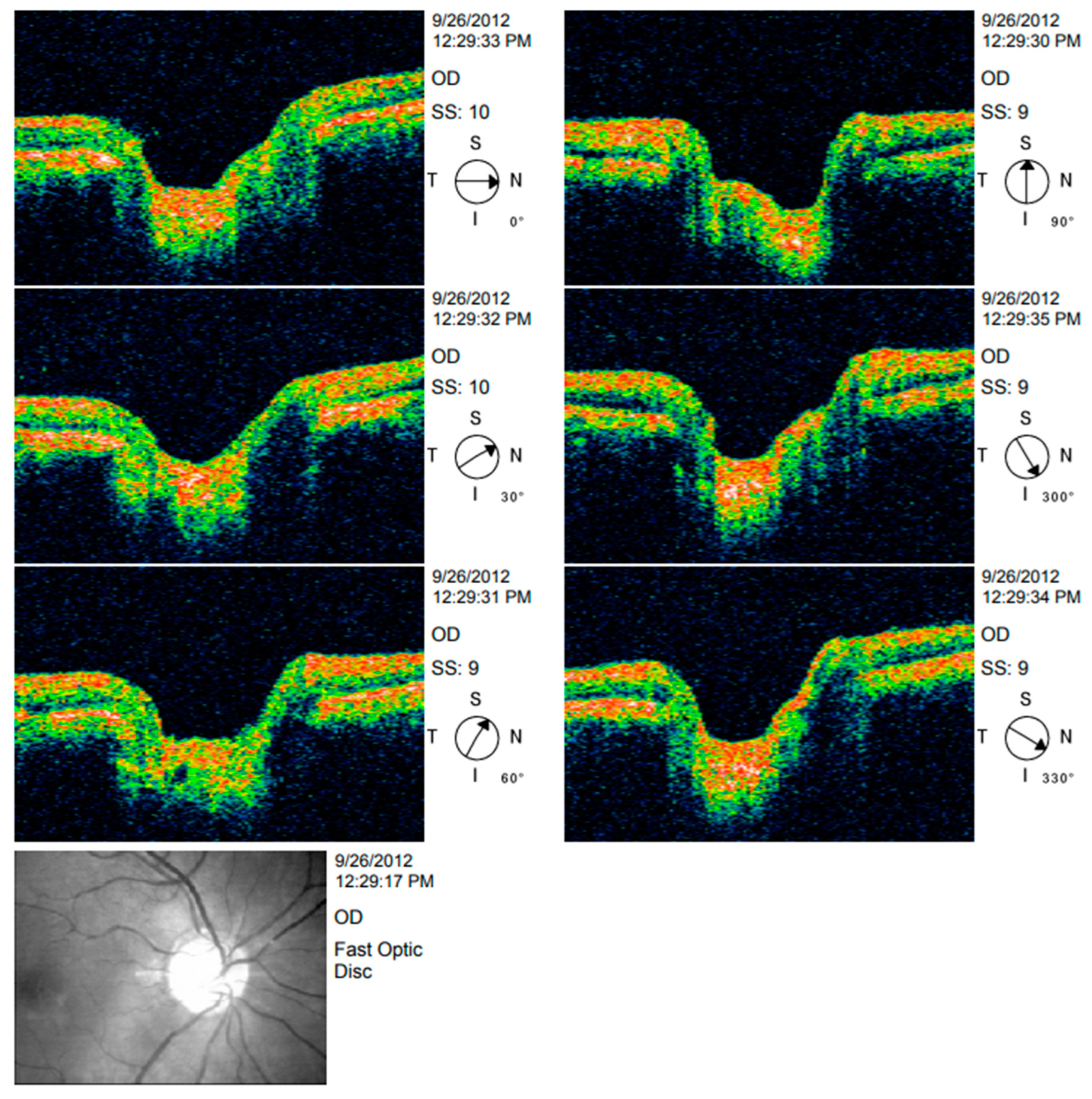 Ijerph 20 01273 g004 Ijerph 20 01273 g004
