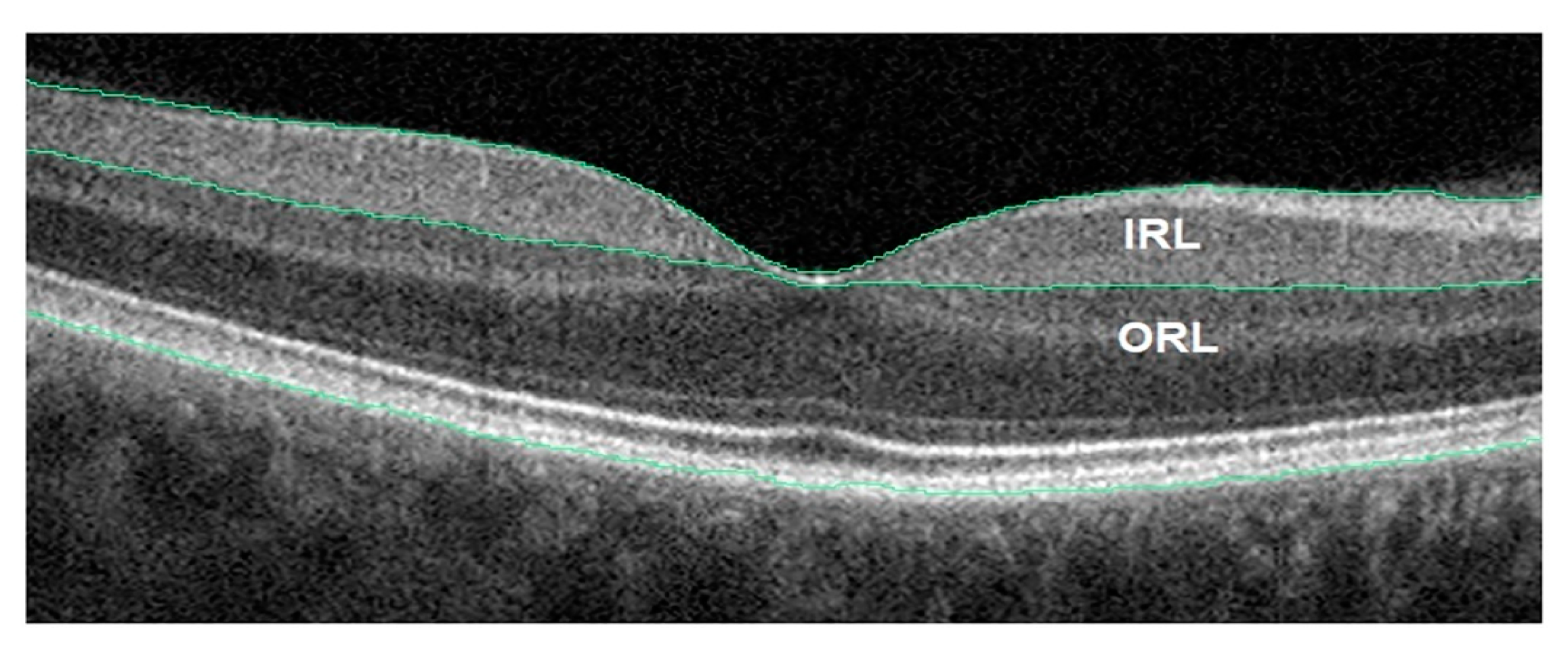Ijerph 20 01273 g006 Ijerph 20 01273 g006