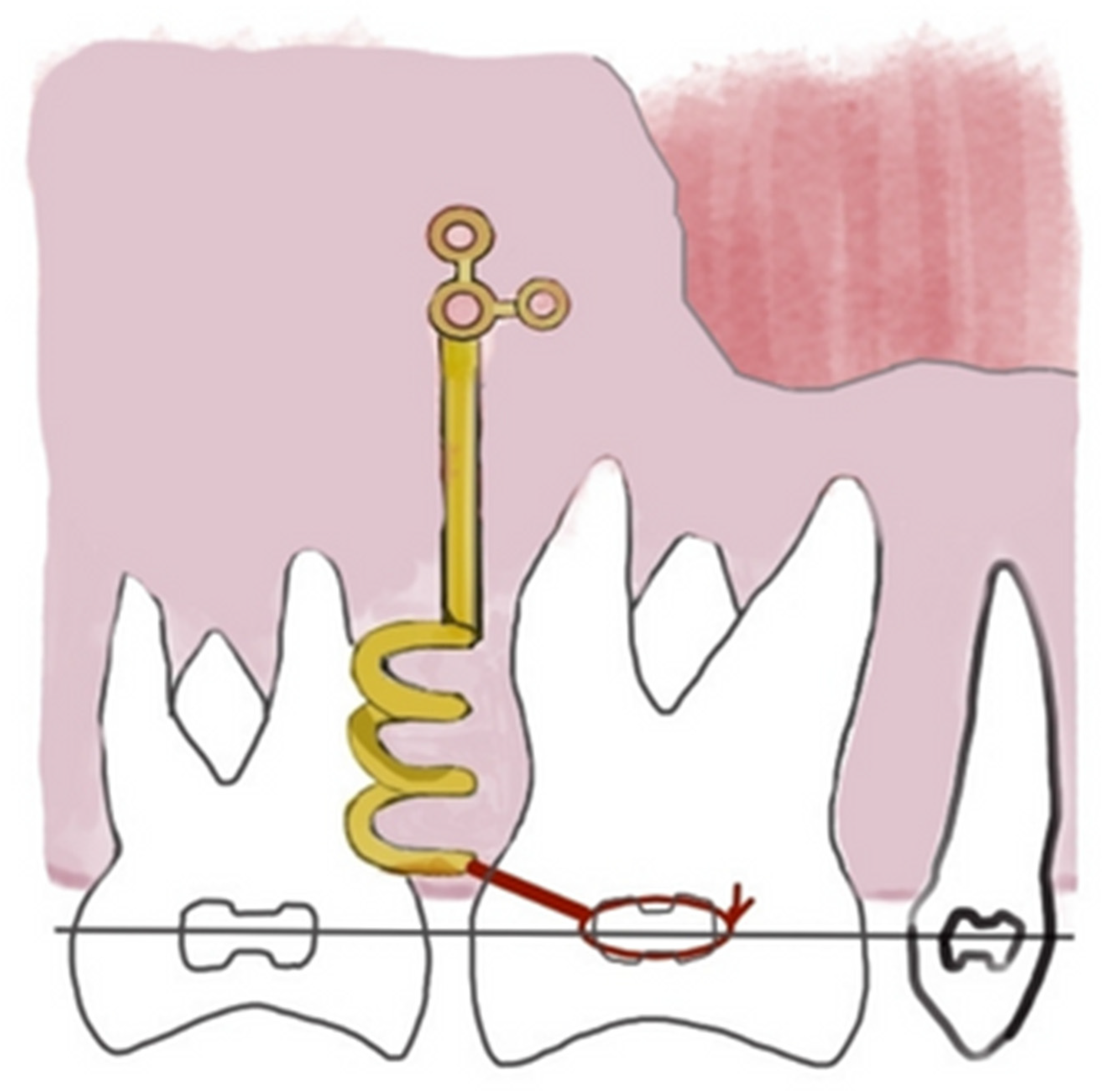 Ijerph 20 01562 g001 Ijerph 20 01562 g001