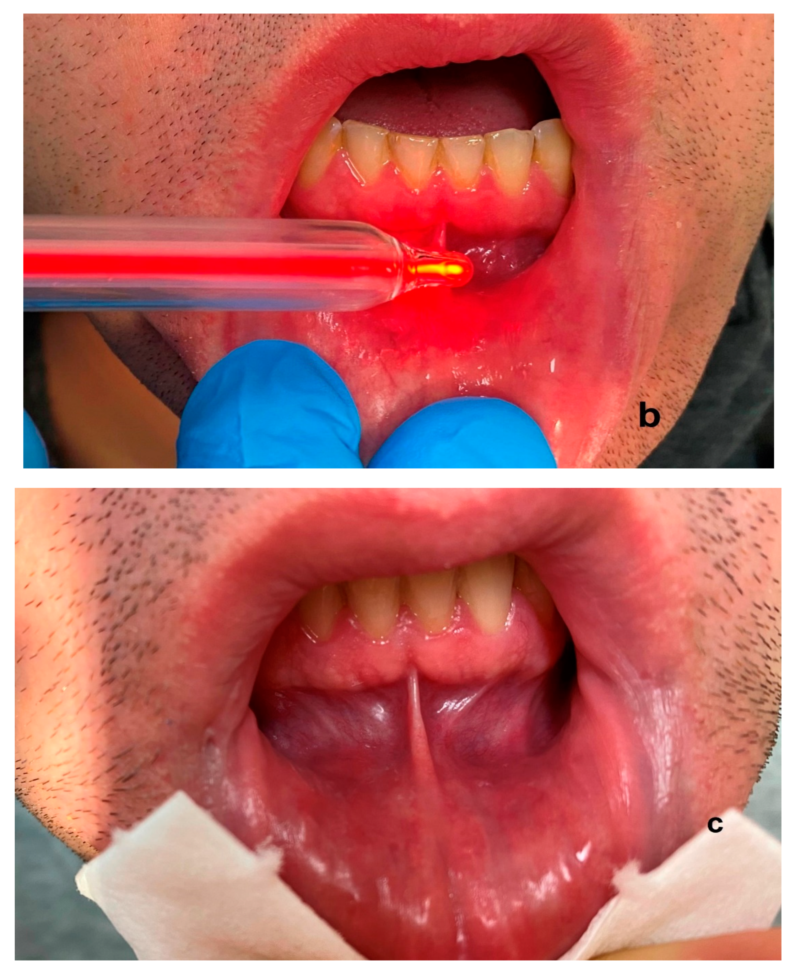 Ijerph 20 02048 g004b Ijerph 20 02048 g004b