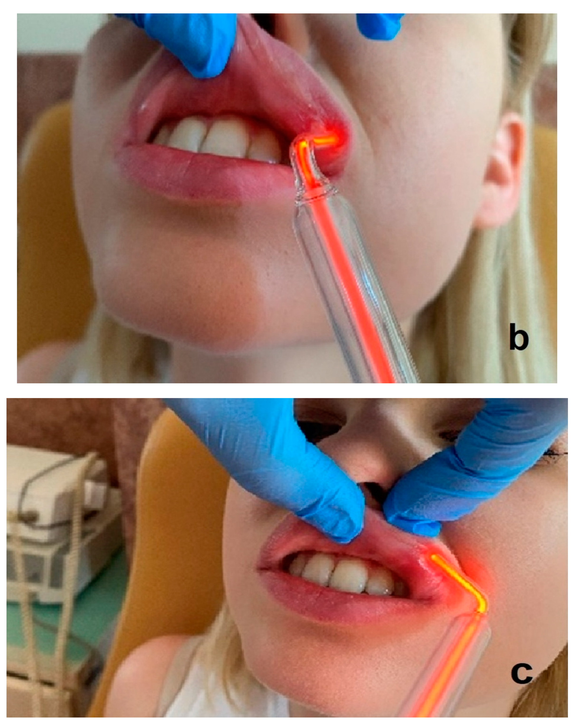 Ijerph 20 02048 g005b Ijerph 20 02048 g005b