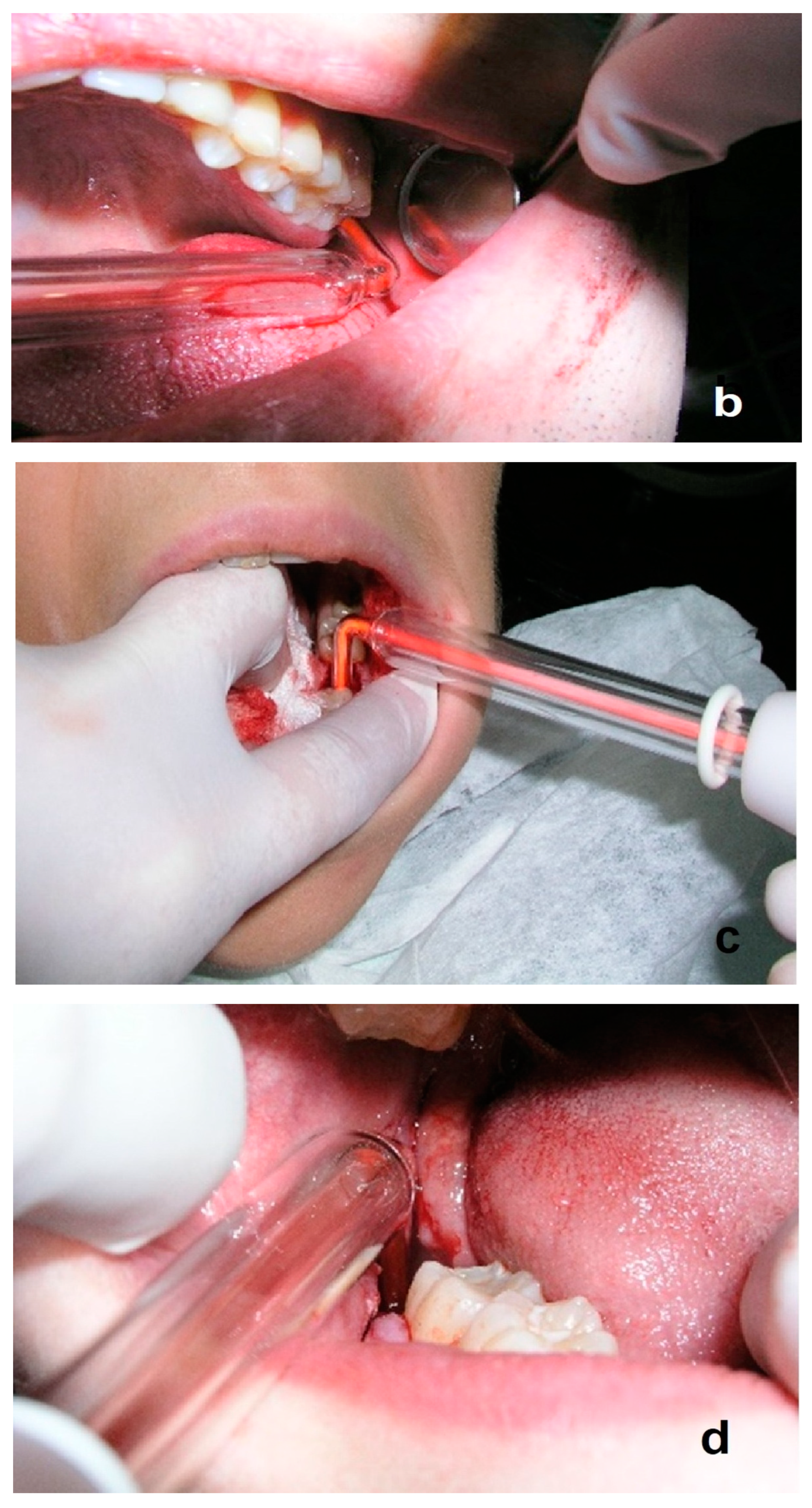 Ijerph 20 02048 g006b Ijerph 20 02048 g006b