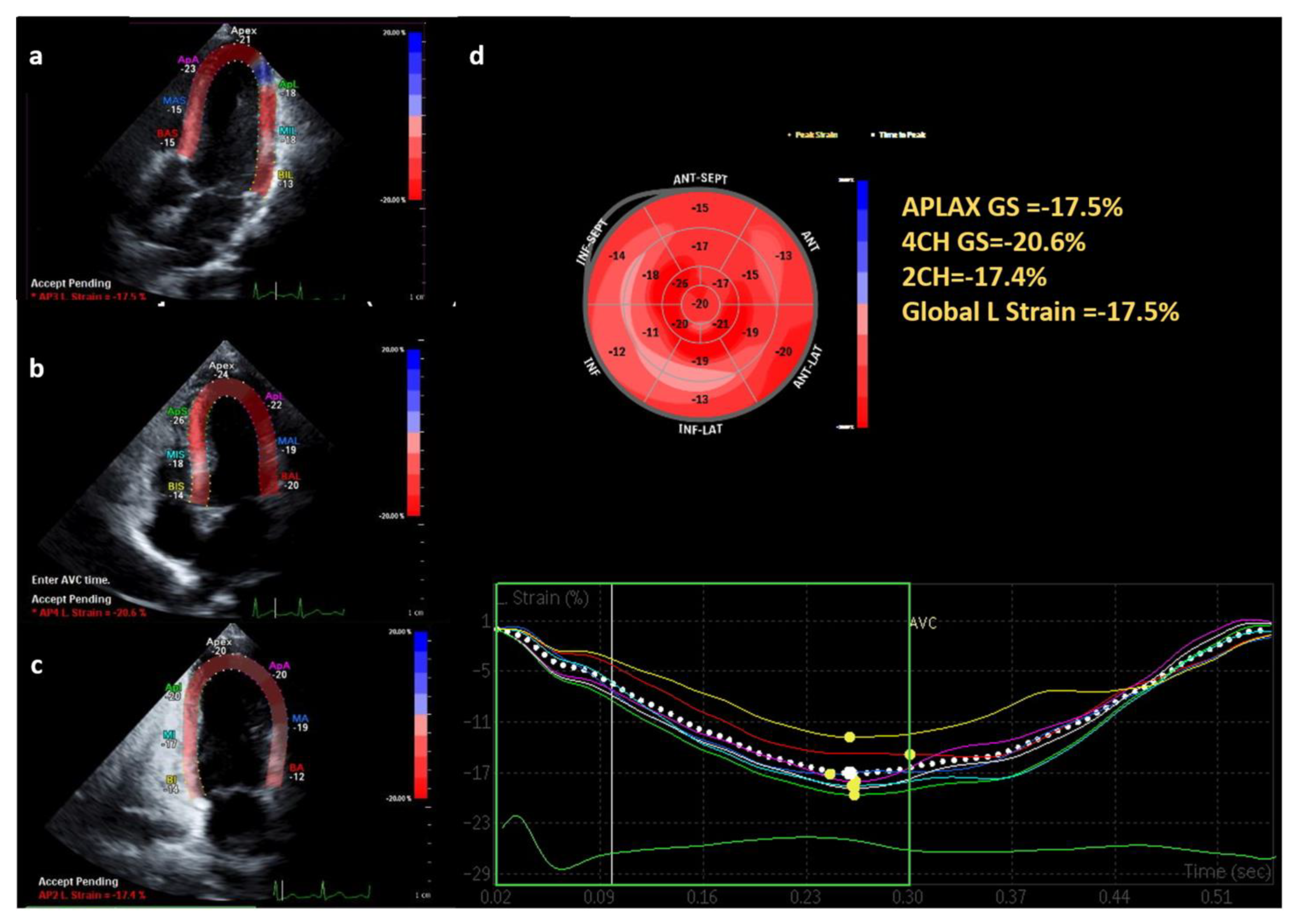 Ijerph 20 02191 g003 Ijerph 20 02191 g003