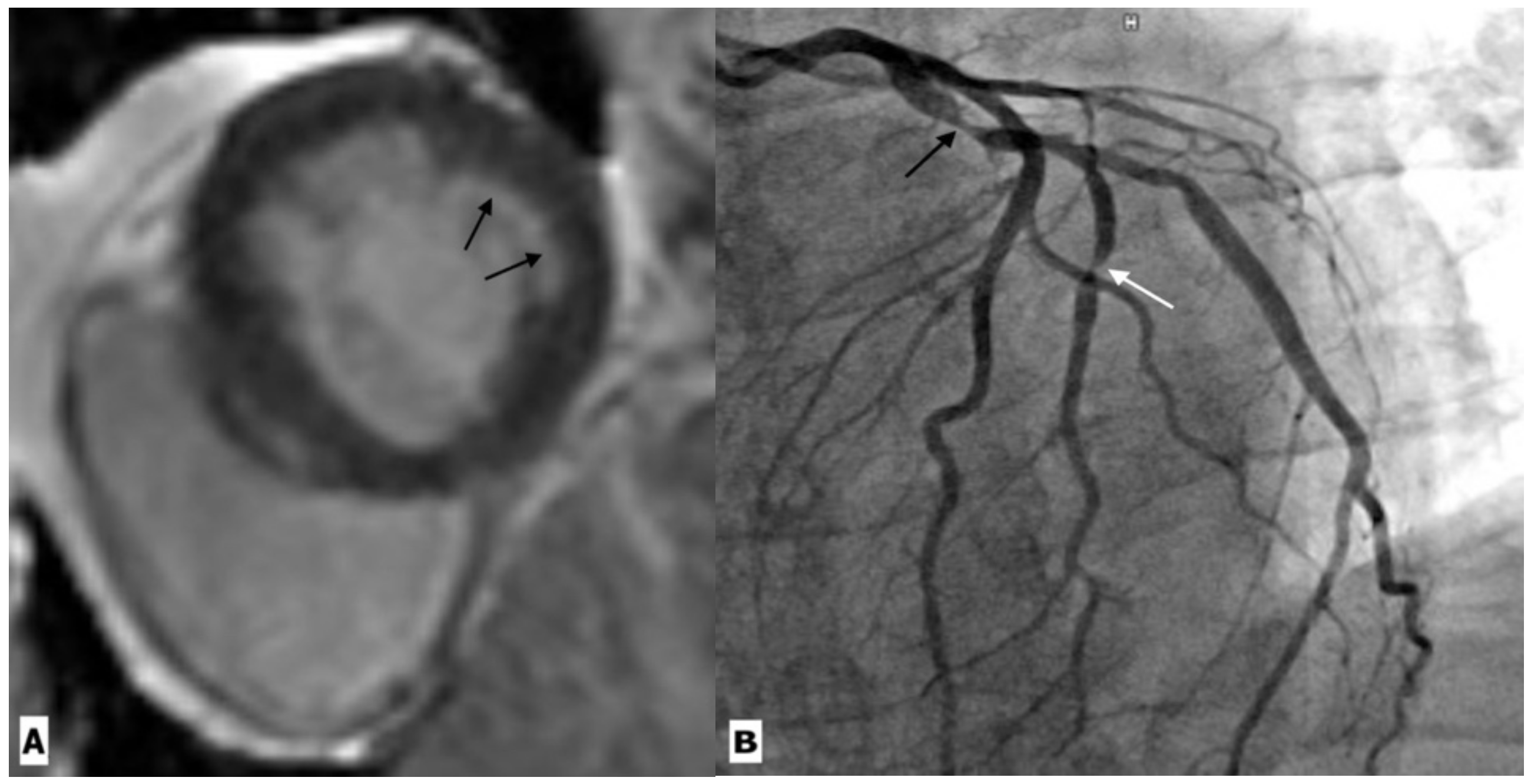 Ijerph 20 02201 g004 Ijerph 20 02201 g004
