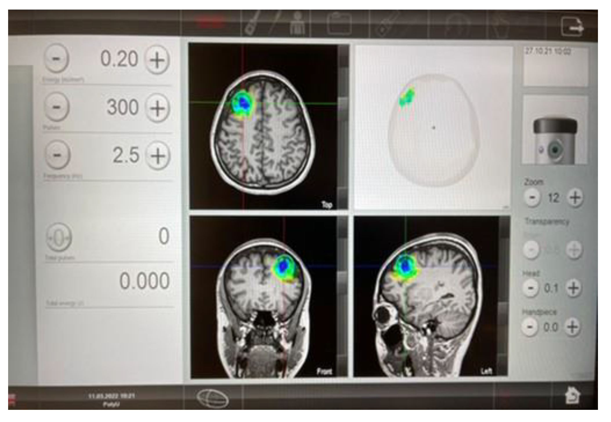 Ijerph 20 02333 g004