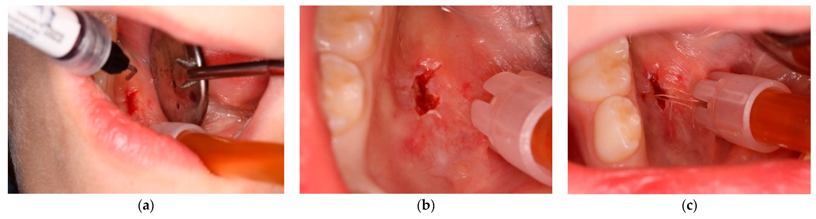 Ijerph 20 02398 g005
