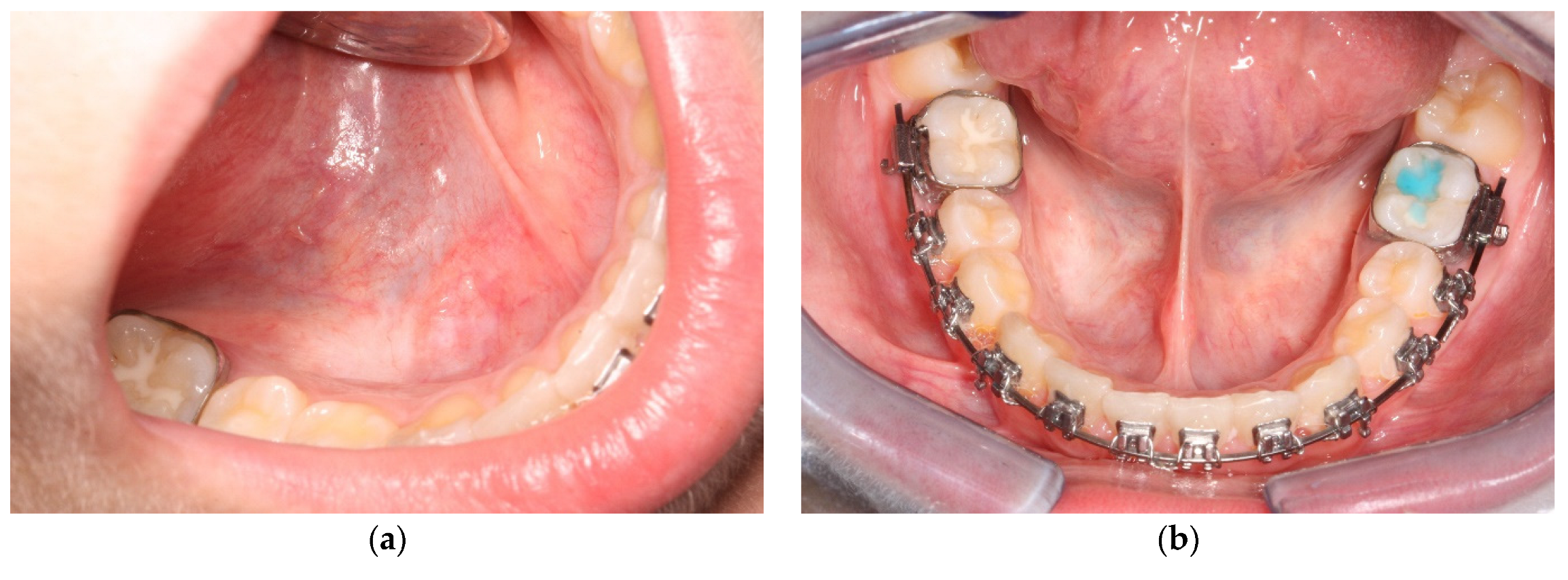 Ijerph 20 02398 g008