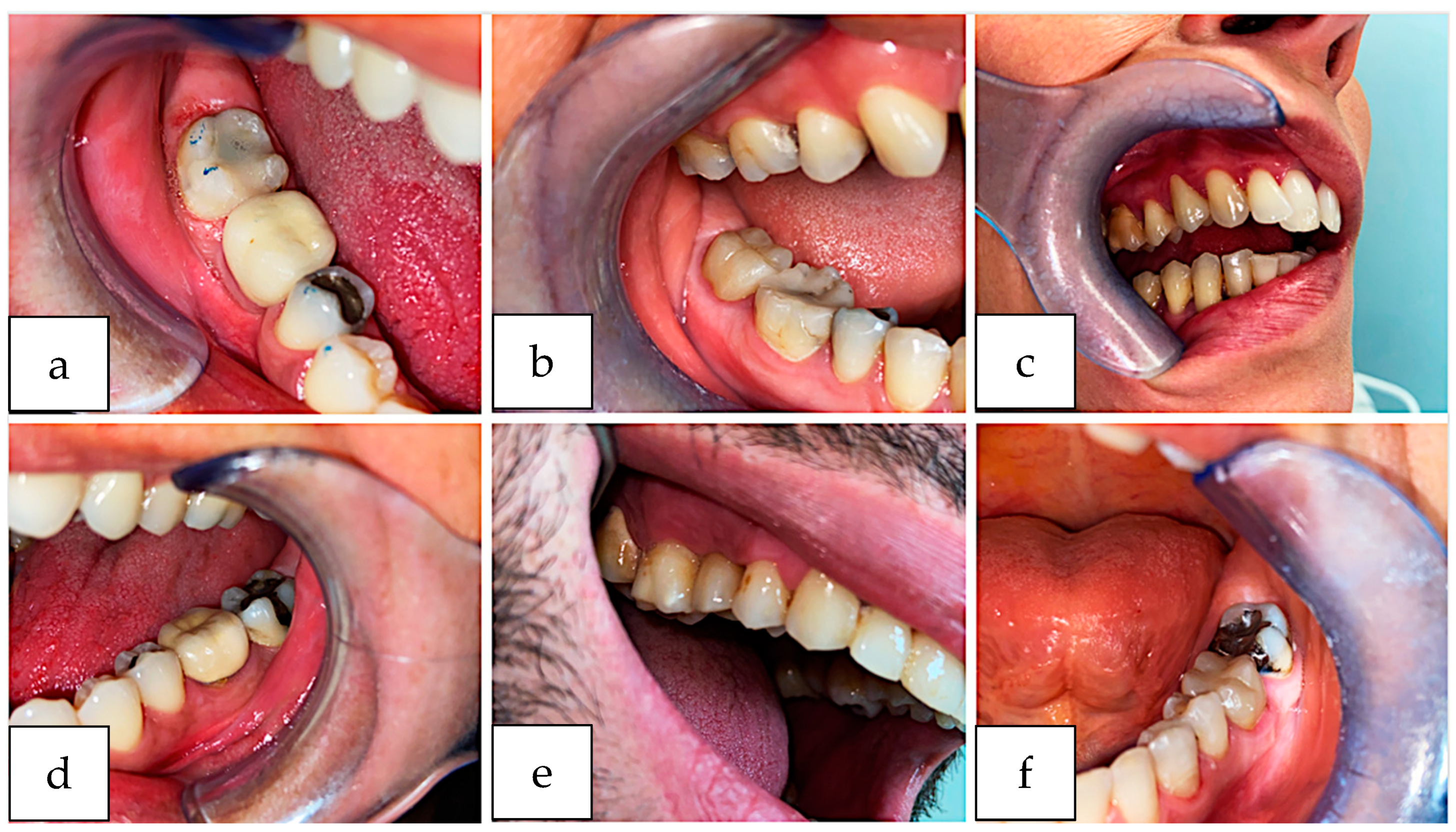 Ijerph 20 02943 g008
