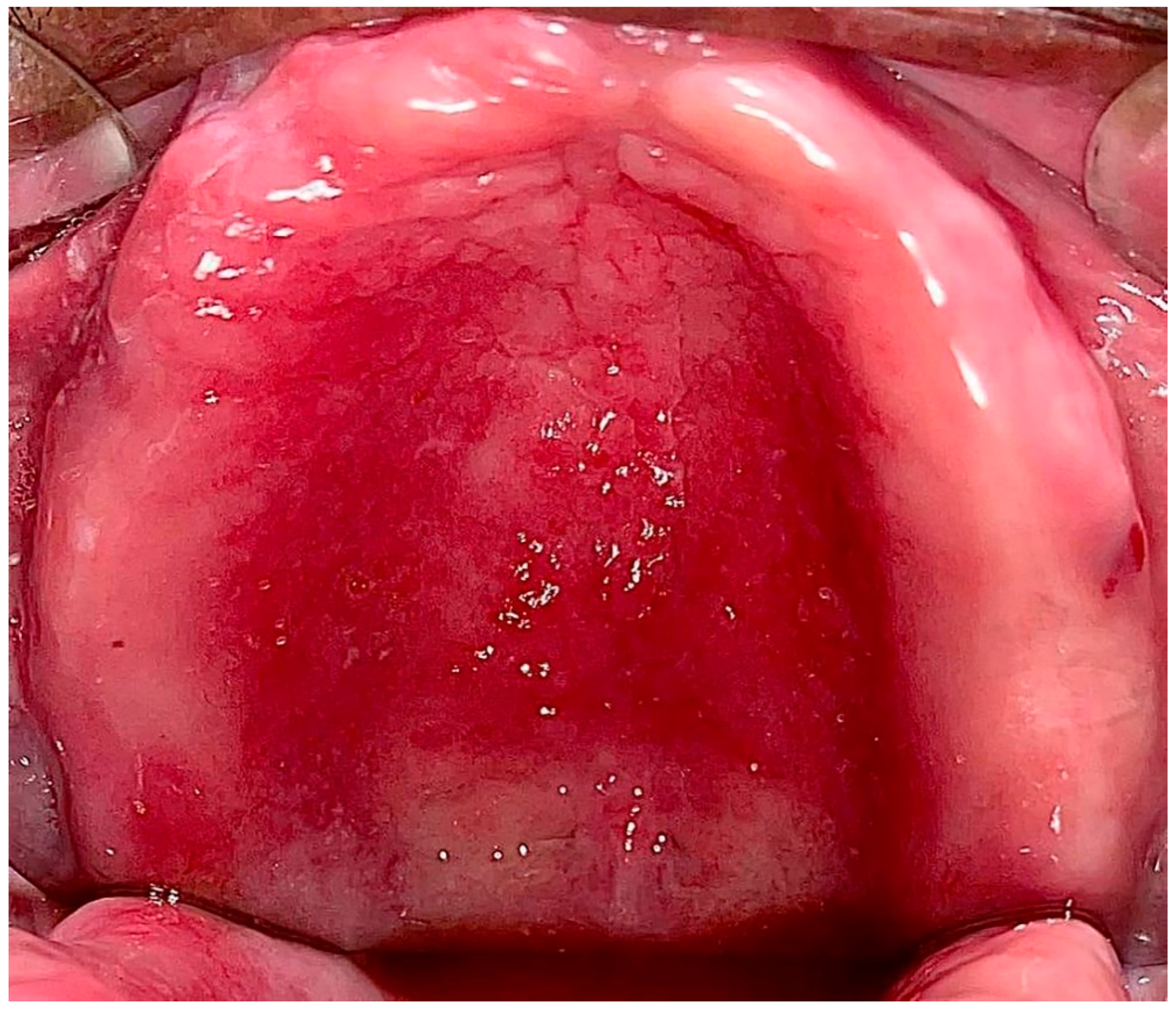 Ijerph 20 03029 g001 Ijerph 20 03029 g001