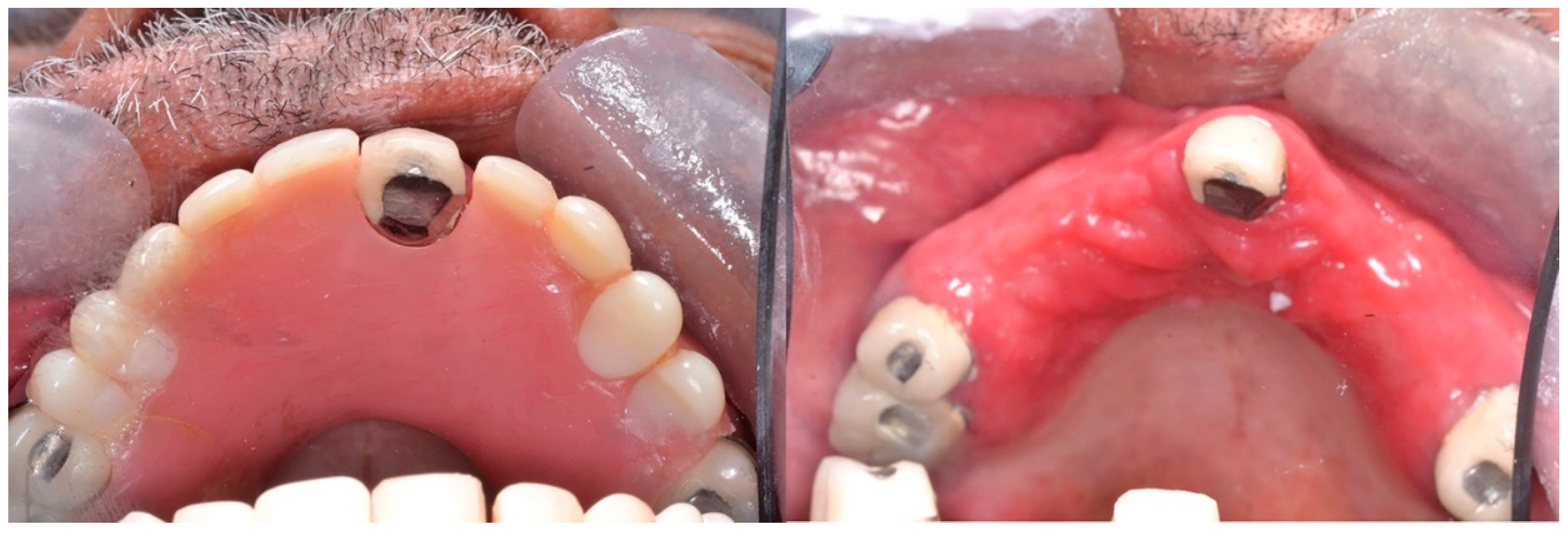 Ijerph 20 03029 g003 Ijerph 20 03029 g003