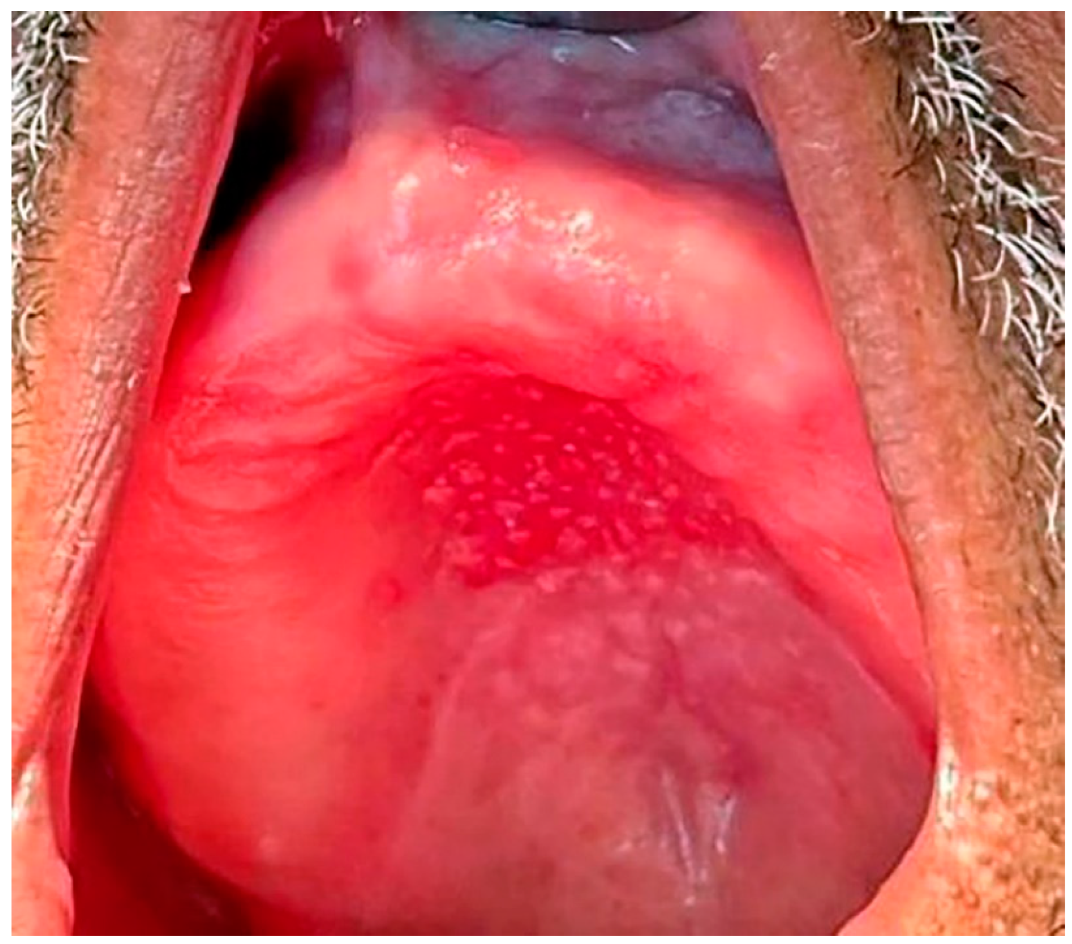 Ijerph 20 03029 g004 Ijerph 20 03029 g004