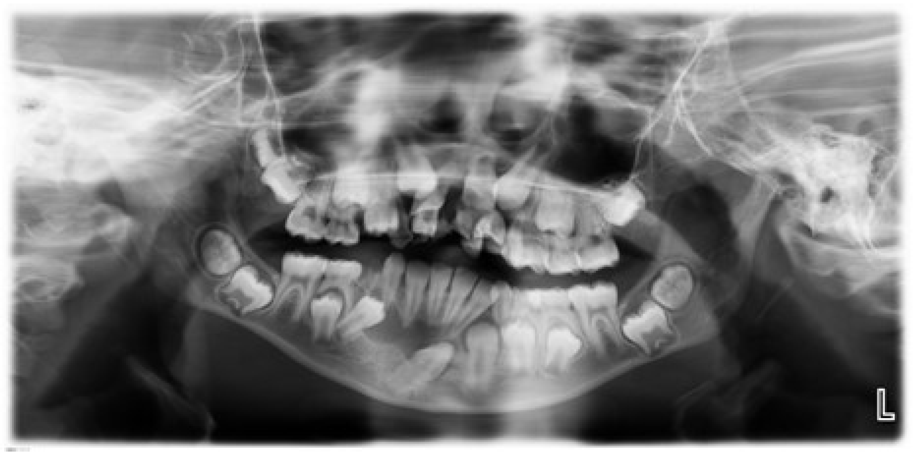IJERPH Free FullText Incidental Pathologic Findings from