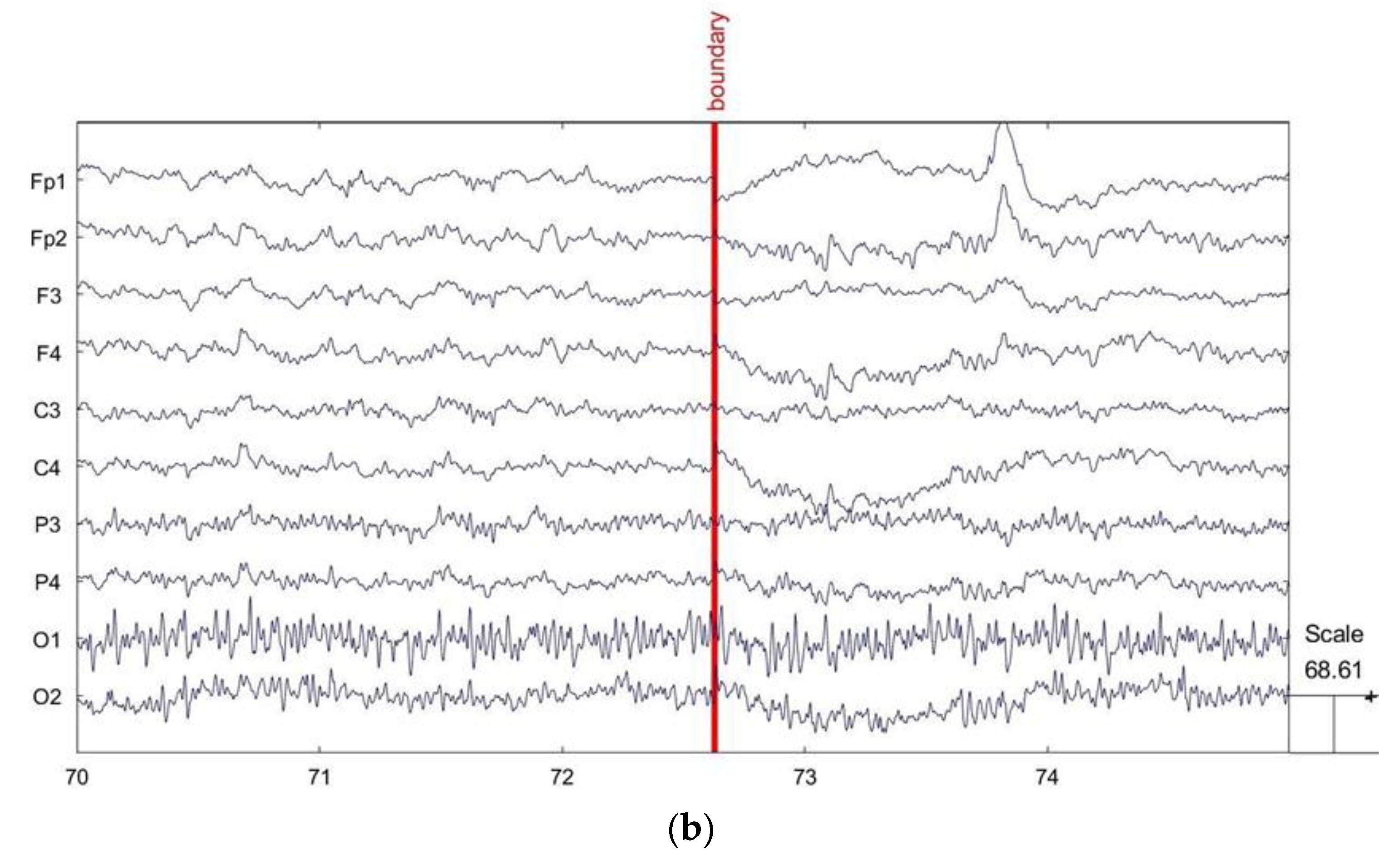 Ijerph 20 03487 g002b