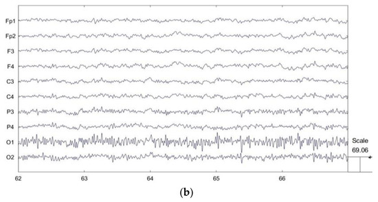 Multi-Level Attention Recognition of EEG Based on Feature Selection