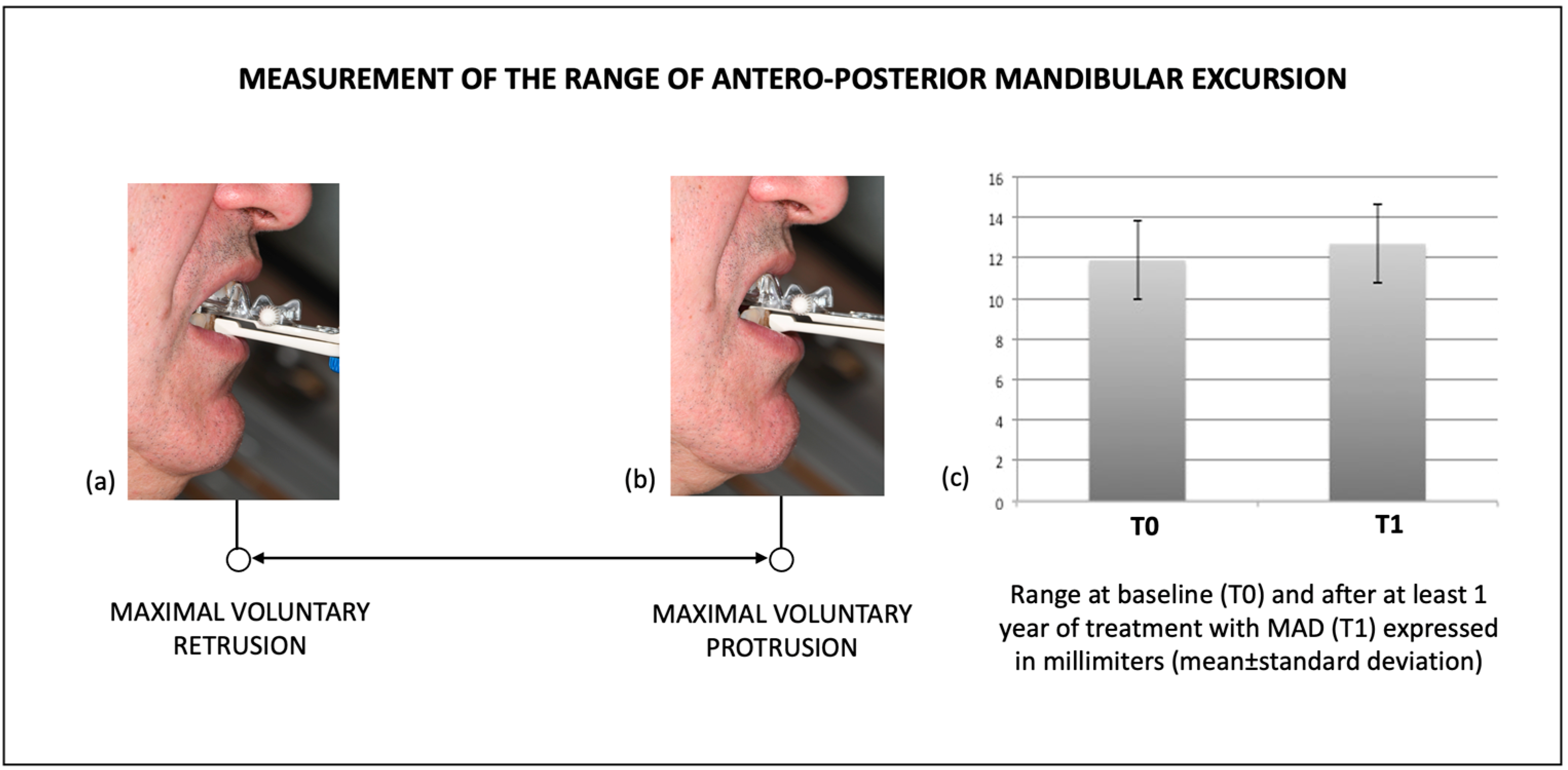 IJERPH Free FullText AnteroPosterior Mandibular Excursion in