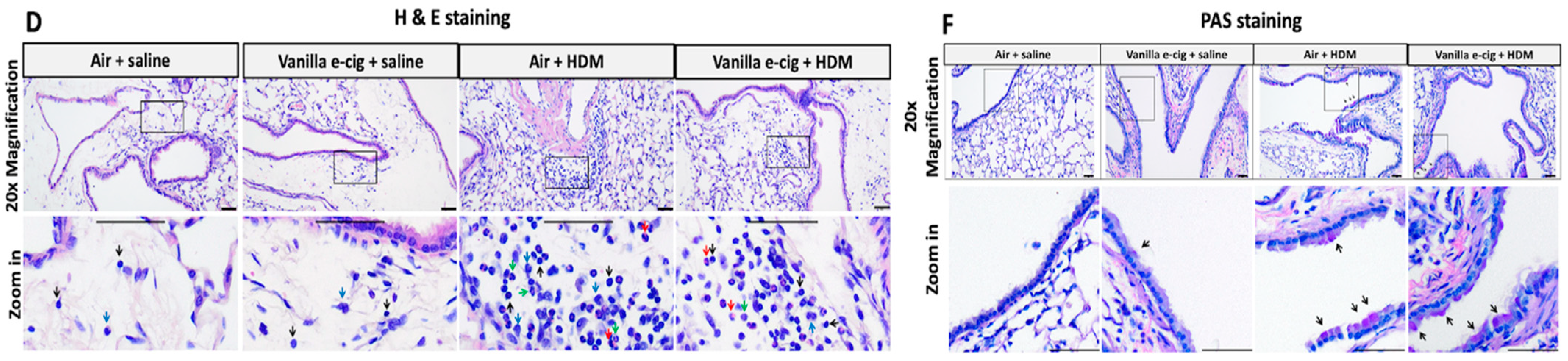Ijerph 20 03710 g005b Ijerph 20 03710 g005b