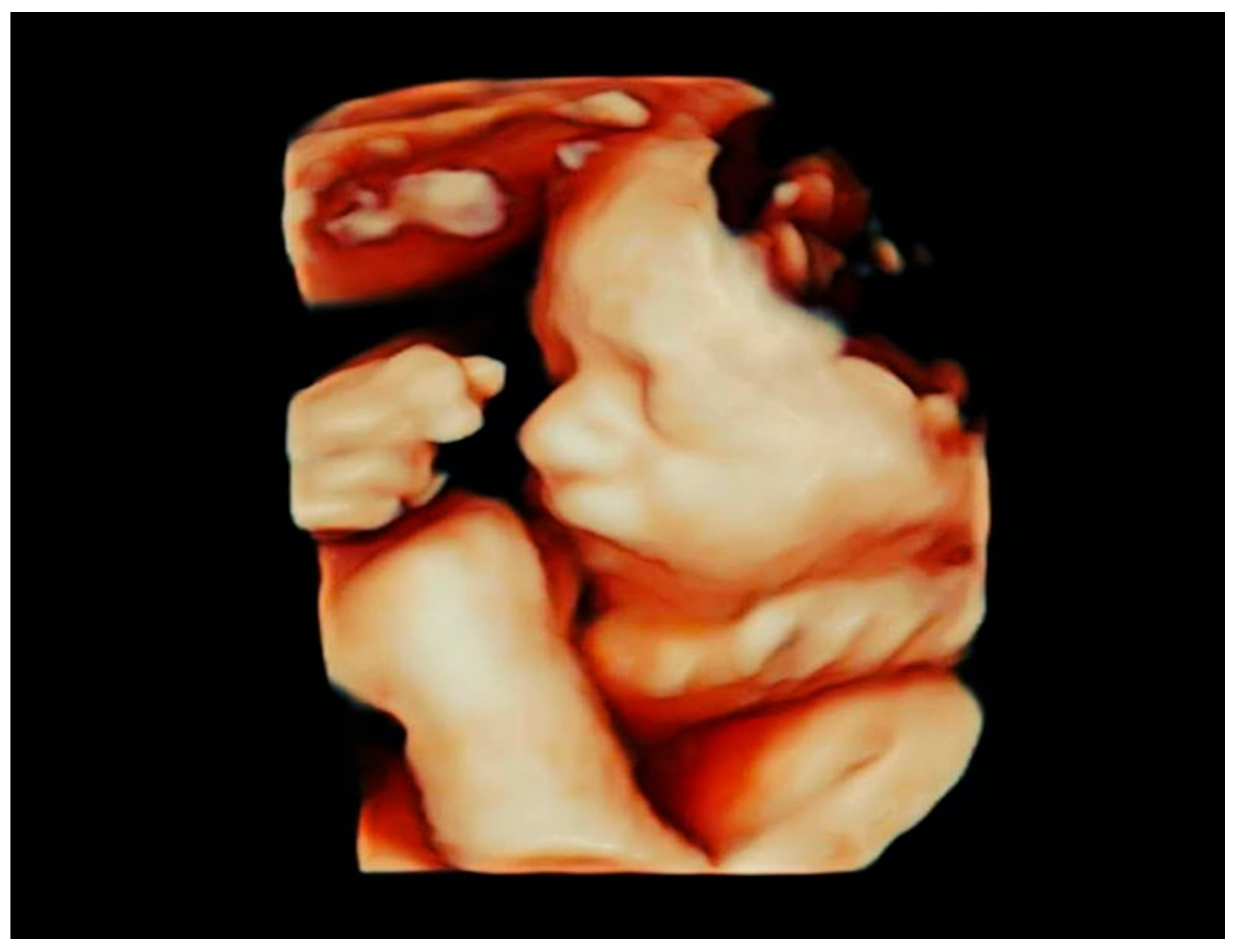 Ijerph 20 03778 g001