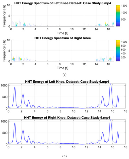 Empirical Mode Decomposition and Hilbert Spectrum for Abnormality ...