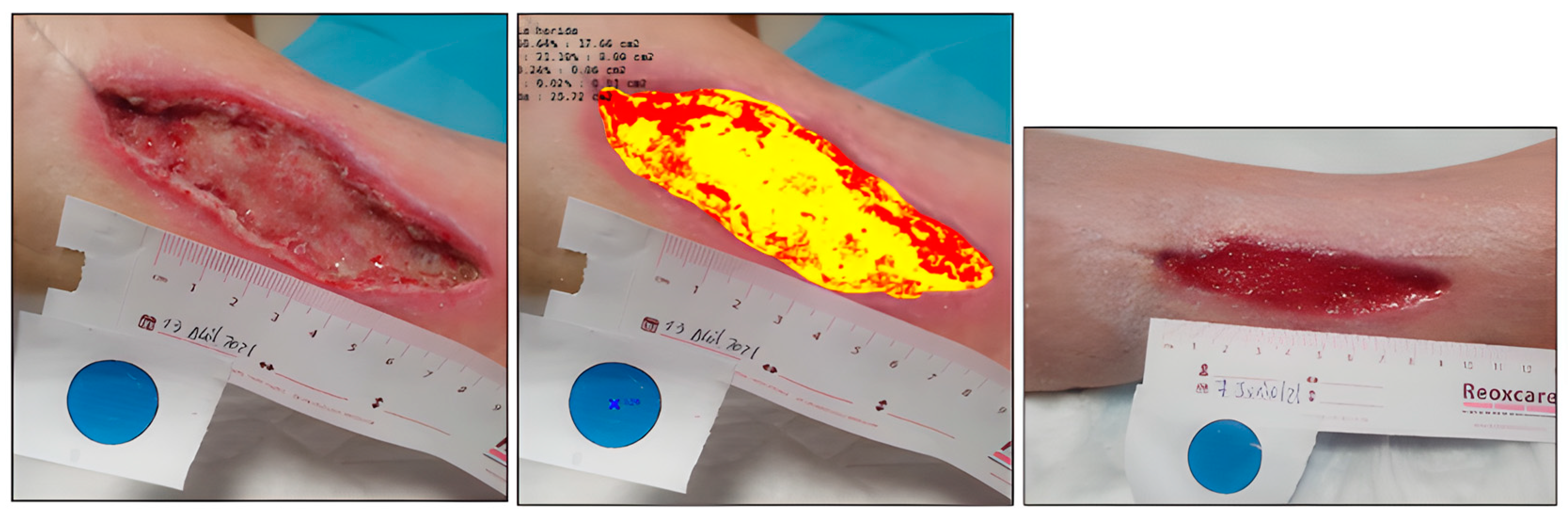 Ijerph 20 04147 g011