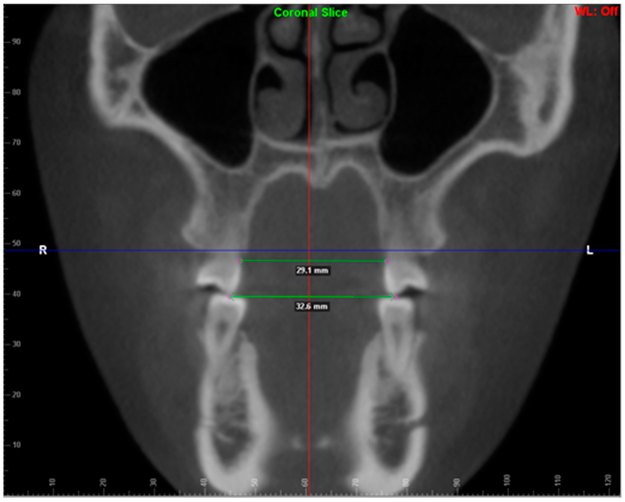 Ijerph 20 04318 g002