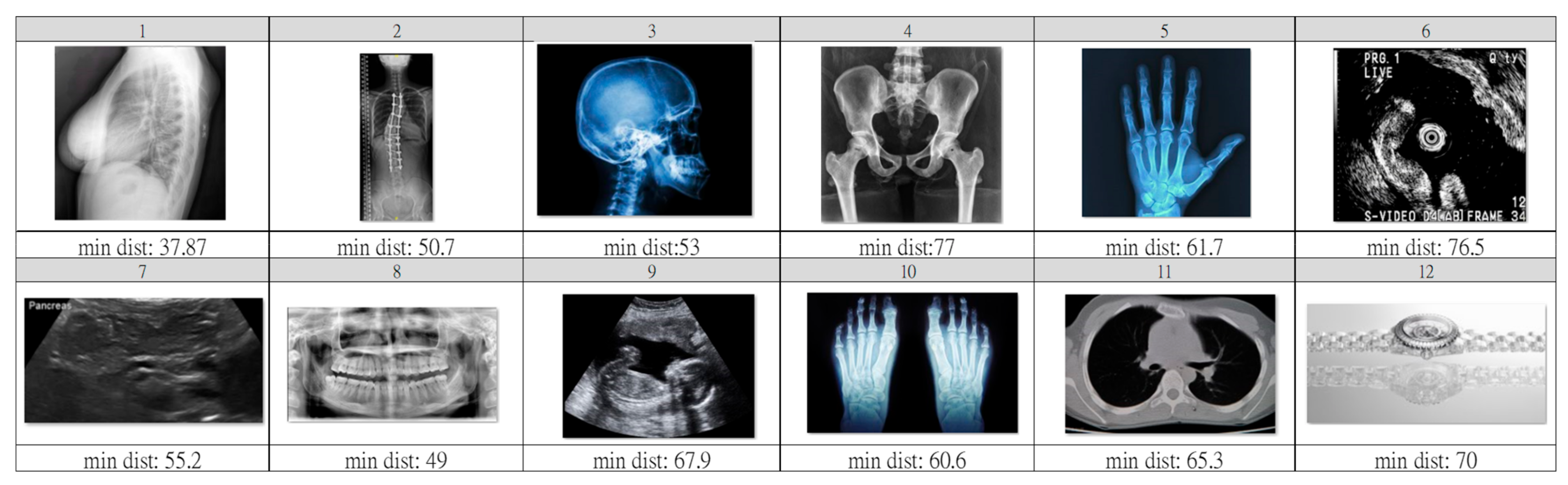 IJERPH Free FullText Deep Learning Algorithms with LIME and