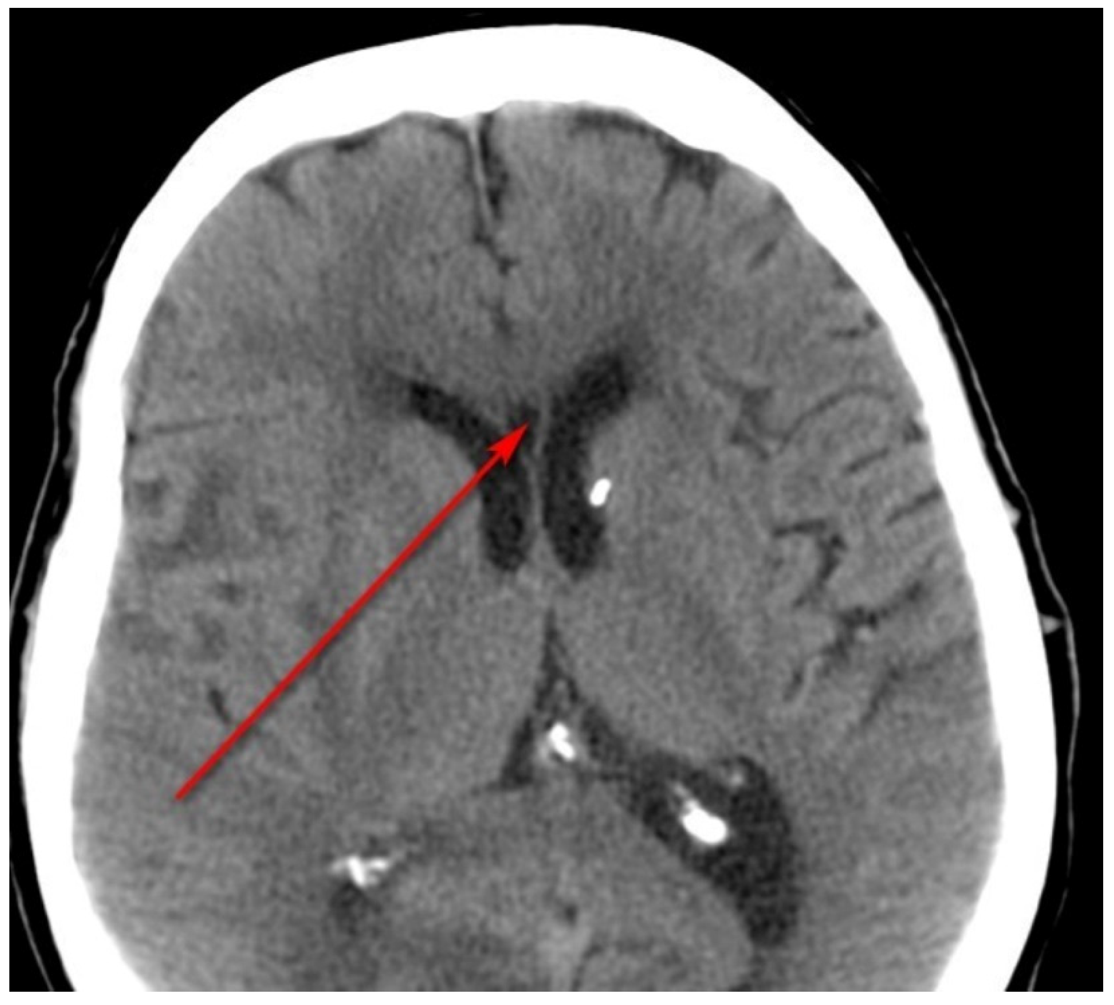 Ijerph 20 04592 g003