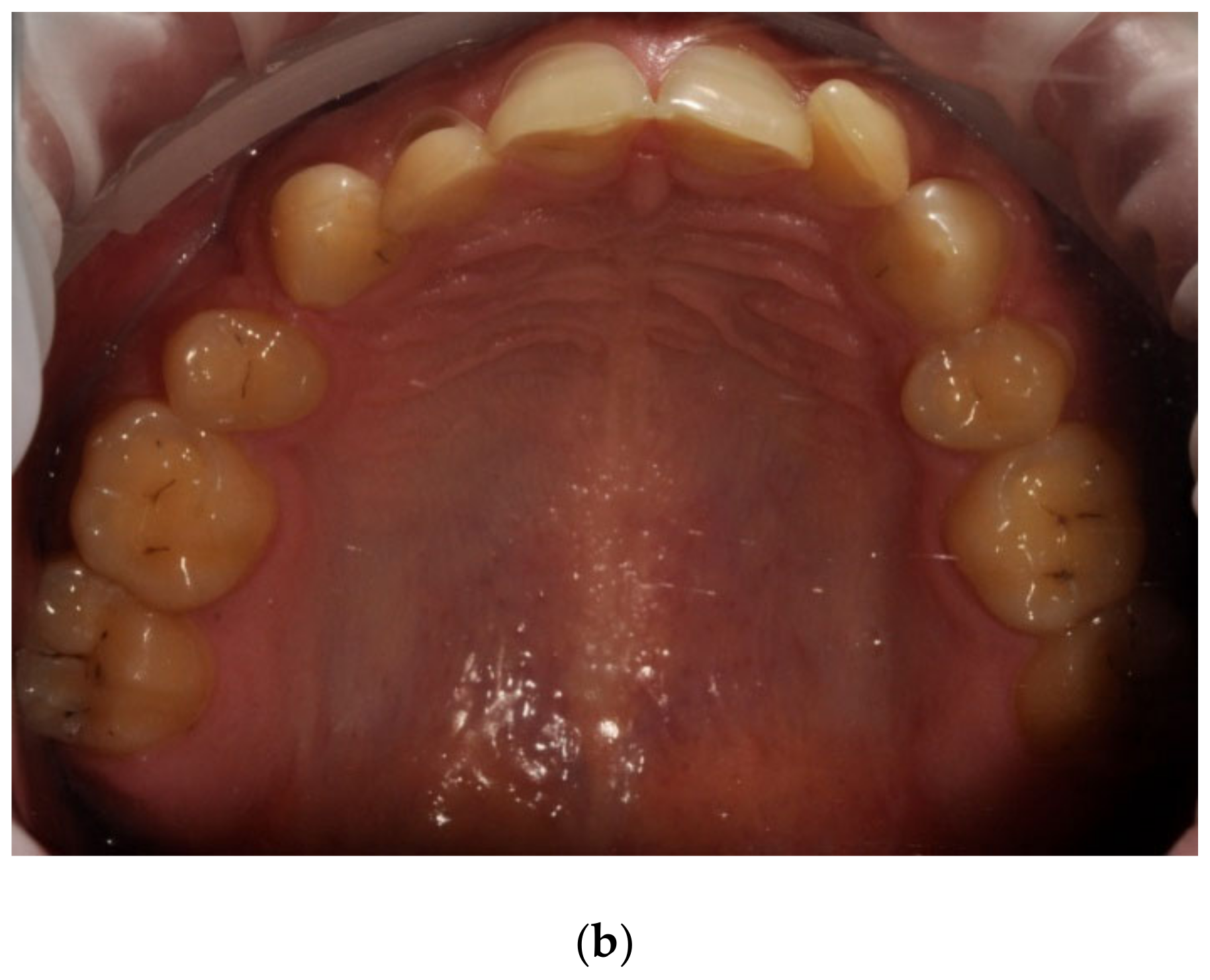 Ijerph 20 04792 g007b