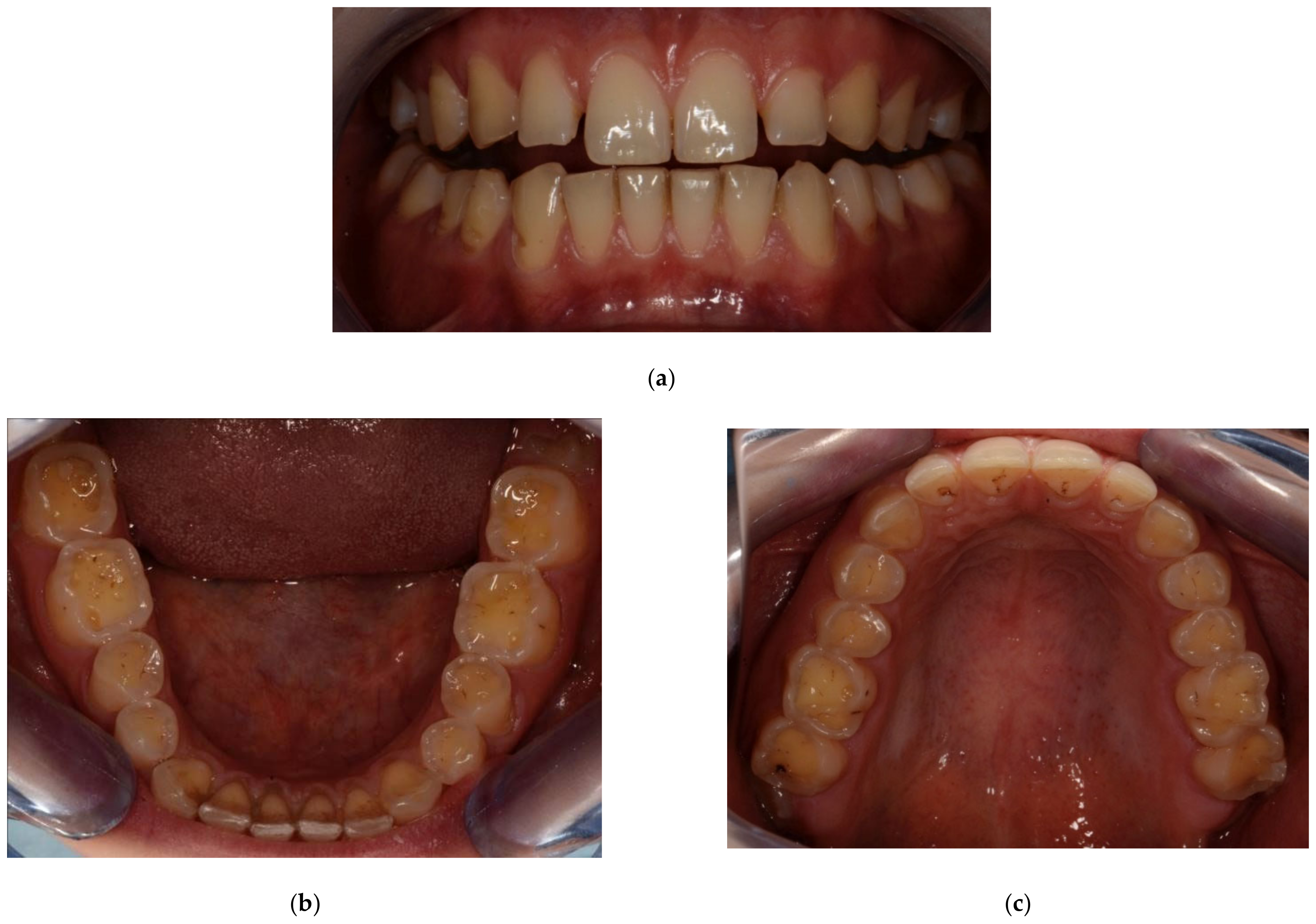 Ijerph 20 04792 g008