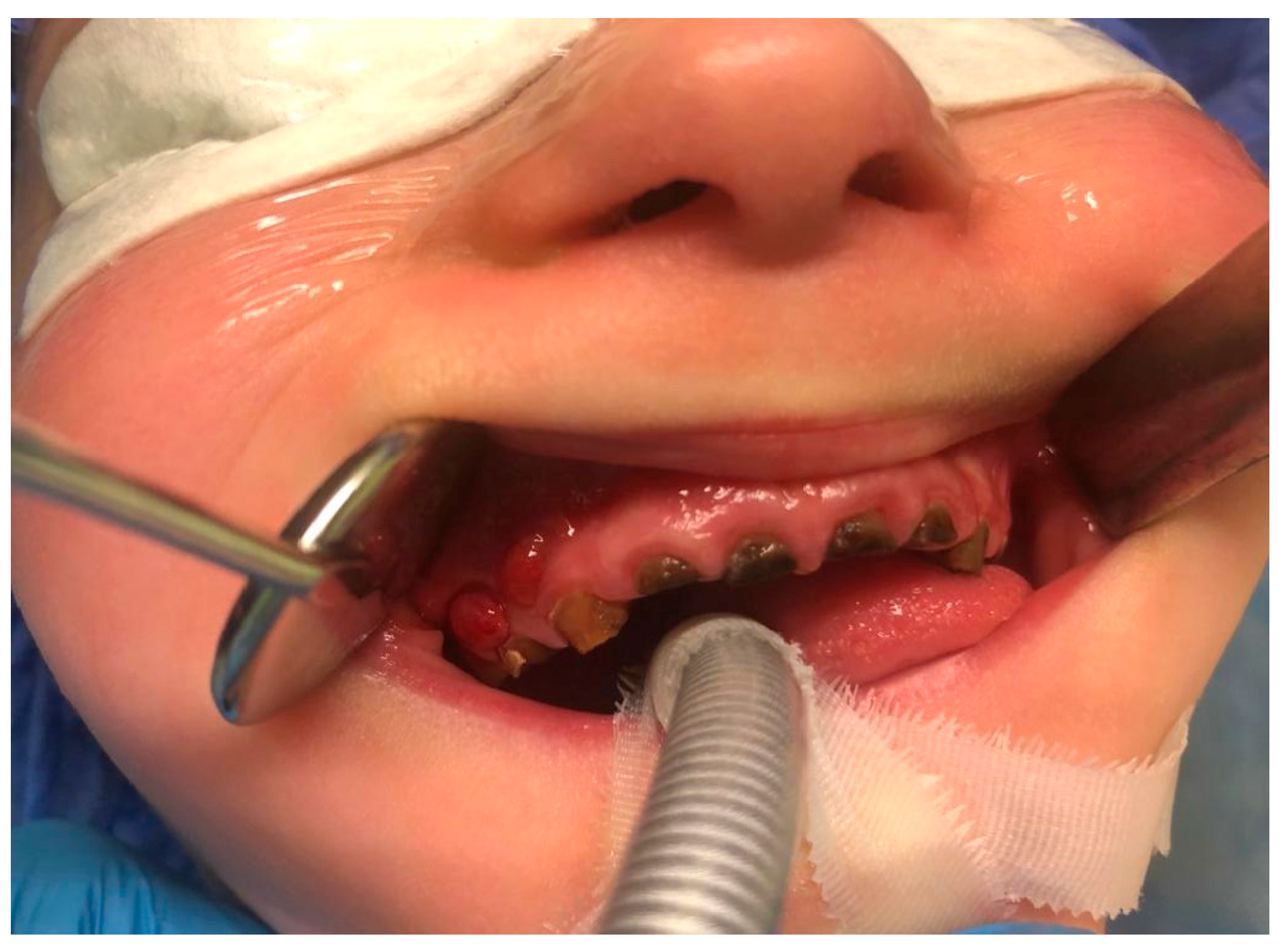 Ijerph 20 04874 g007